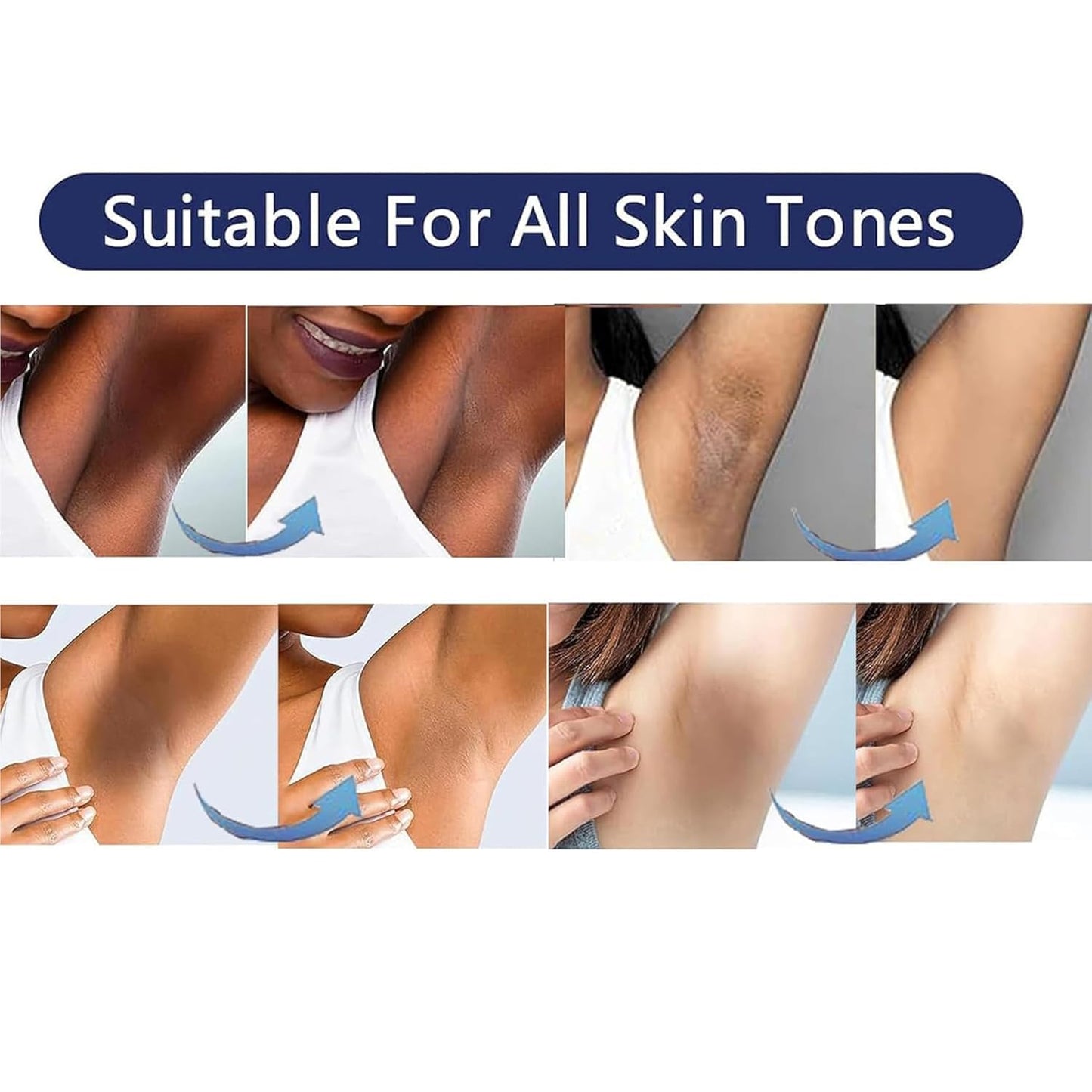 HotSkin Bleaching Cream Skin Lightening for Body Intimate Areas, Private Parts, Underarm, Knees, Elbows, Inner Thigh, Bikini Area, Whitening Cream Dark Spot Remover For Intimate Areas (1FL OZ)