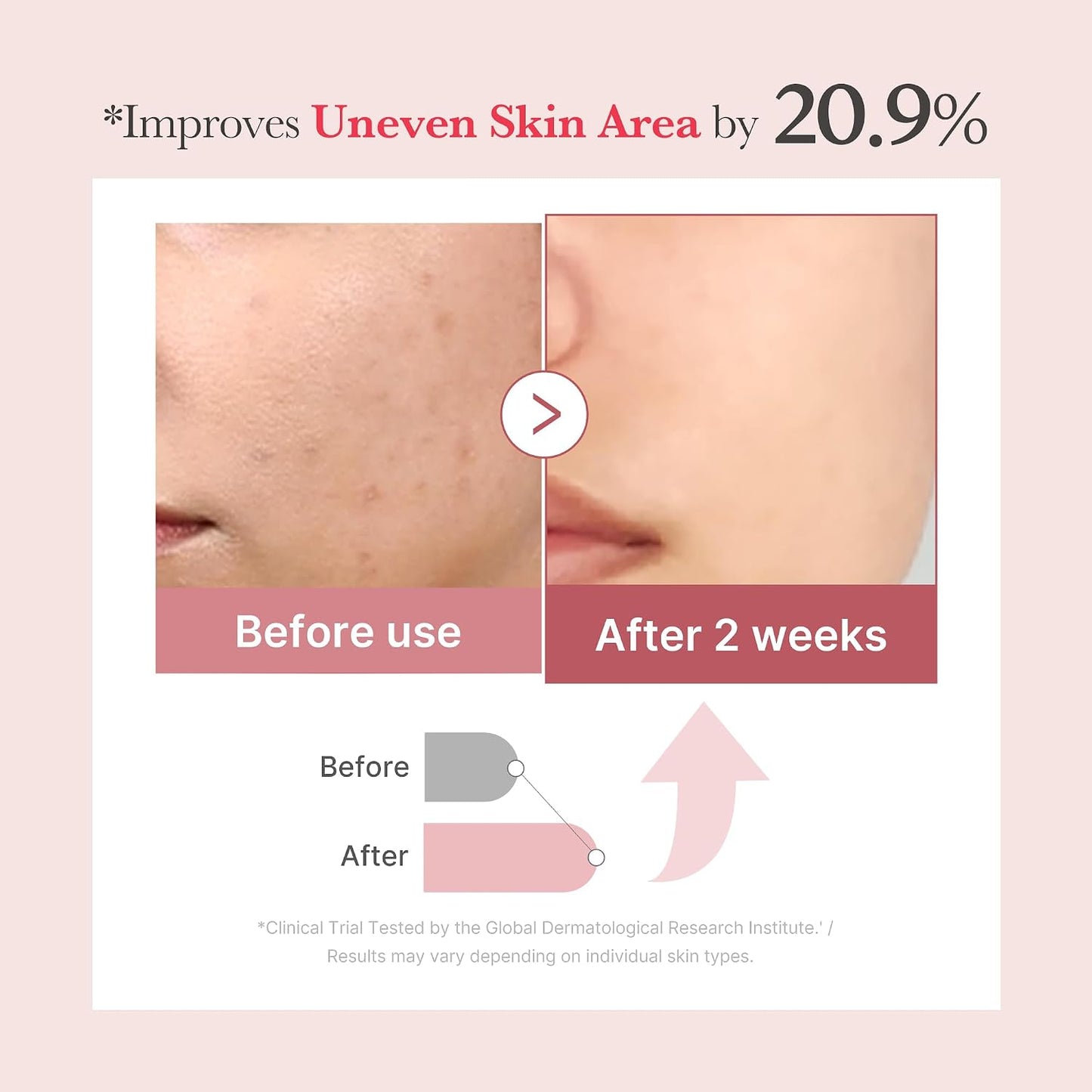 Hotmedicube Exosome Shot PDRN Pink Collagen 7,500 PPM Spicule Facial Serum | Liquid Skin Booster - Exosome, Salmon DNA Spicules - Uneven Skin Tone, Pore Care, Skin Texture, Korean Skincare, 1.01 fl.oz