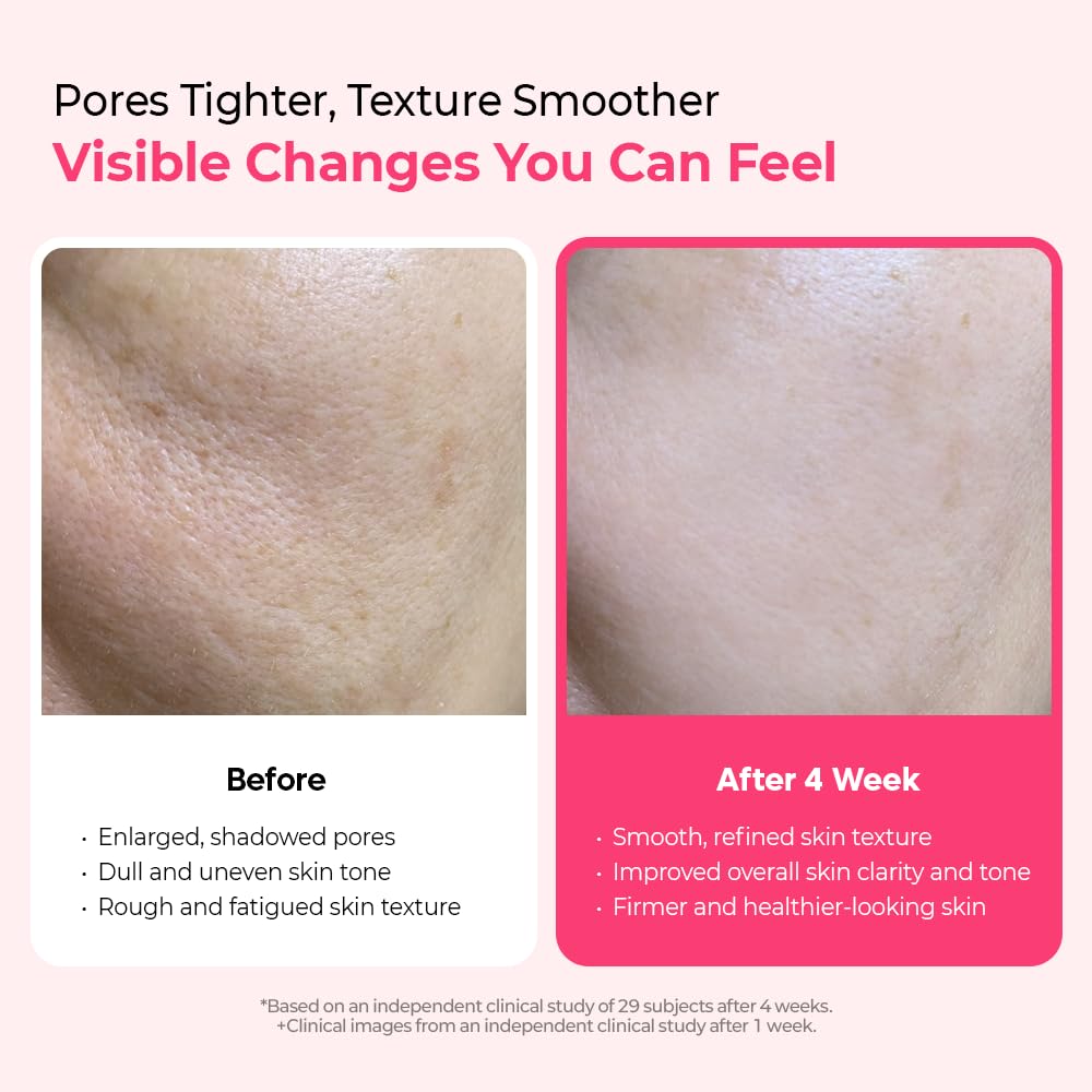 HotDr.Melaxin Cyano Pink Spicule Serum with Vitamin B12, Liquid Microneedle Facial Treatment for Enlarged Pores, Niacinamide for Texture Refining & Renewal, 1.01 fl.oz