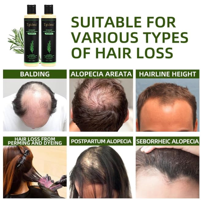 HotTgideas Rosemary & Biotin Shampoo for Thinning Hair, Volumizing Shampoo for Fuller, Thicker Hair, Strengthening & Nourishing Formula with Root Lift, Gentle Daily Care for Women & Men (7.4 fl oz)