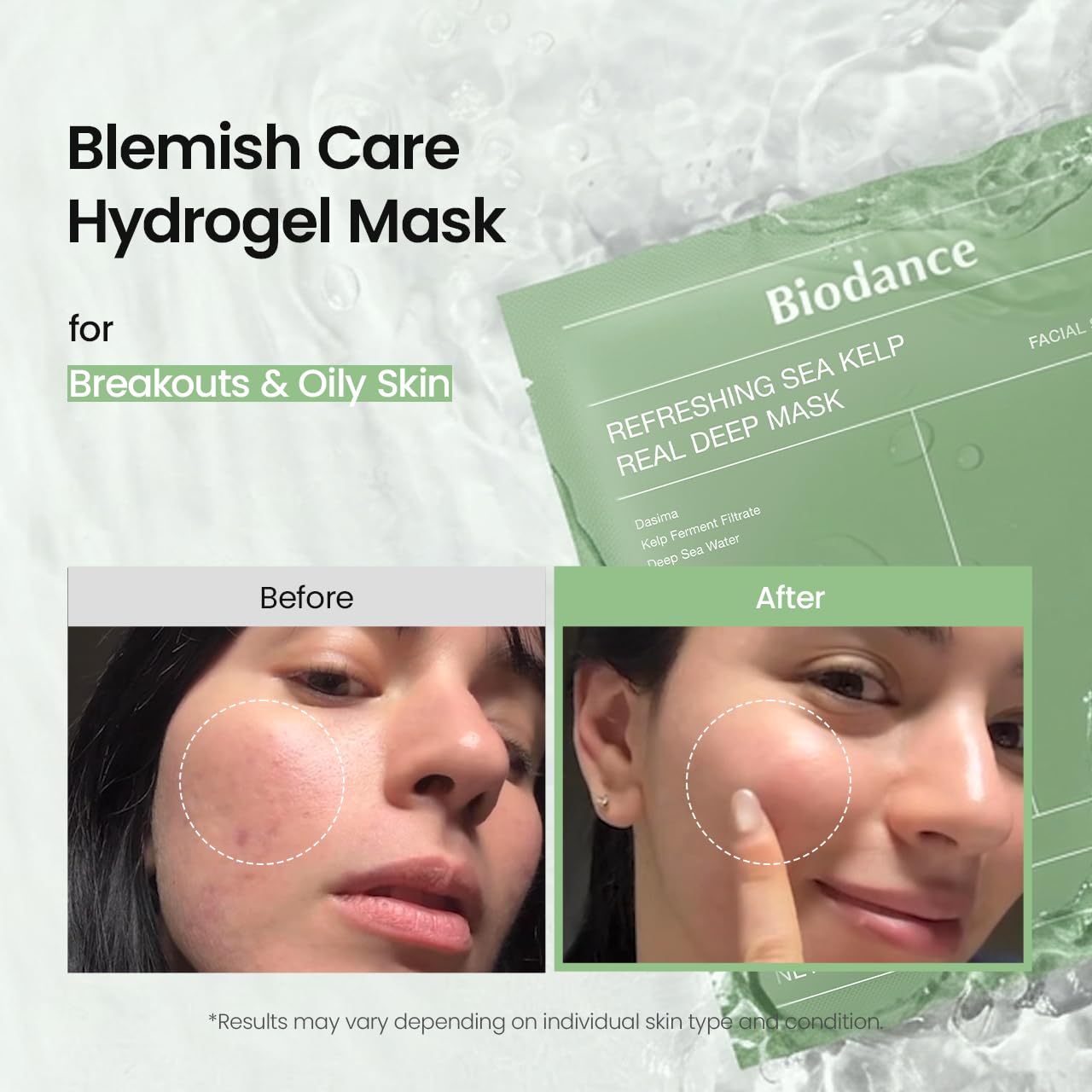 HotBIODANCE Refreshing Sea kelp Real Deep Mask, Overnight Hydrogel Face Mask, Calming, Oil & Sebum Control, Blemish Care, After Sun Care, Sunburn Relief, Korean Skin Care | 1.19oz(34g) x 4ea