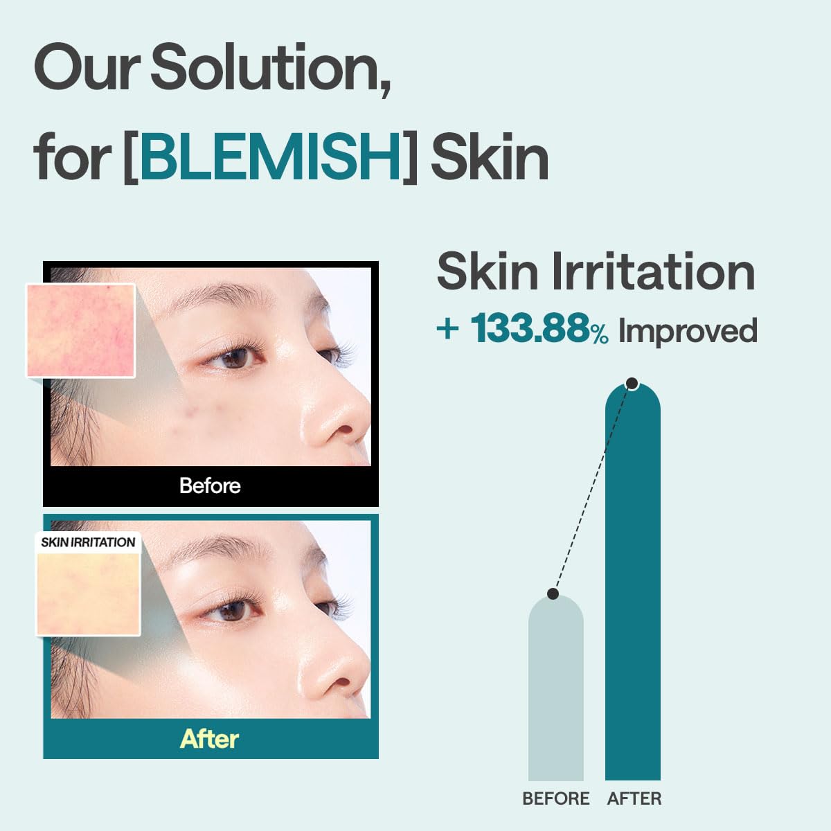 HotMEDIHEAL Madecassoside Essential Face Sheet Mask, Blemish Repair (10ea) | with Centella Asiatica, Ceramide for Soothing Care | Suitable for Sensitive Skin | Plastic-Free Vegan Sheet | Korean Skincare