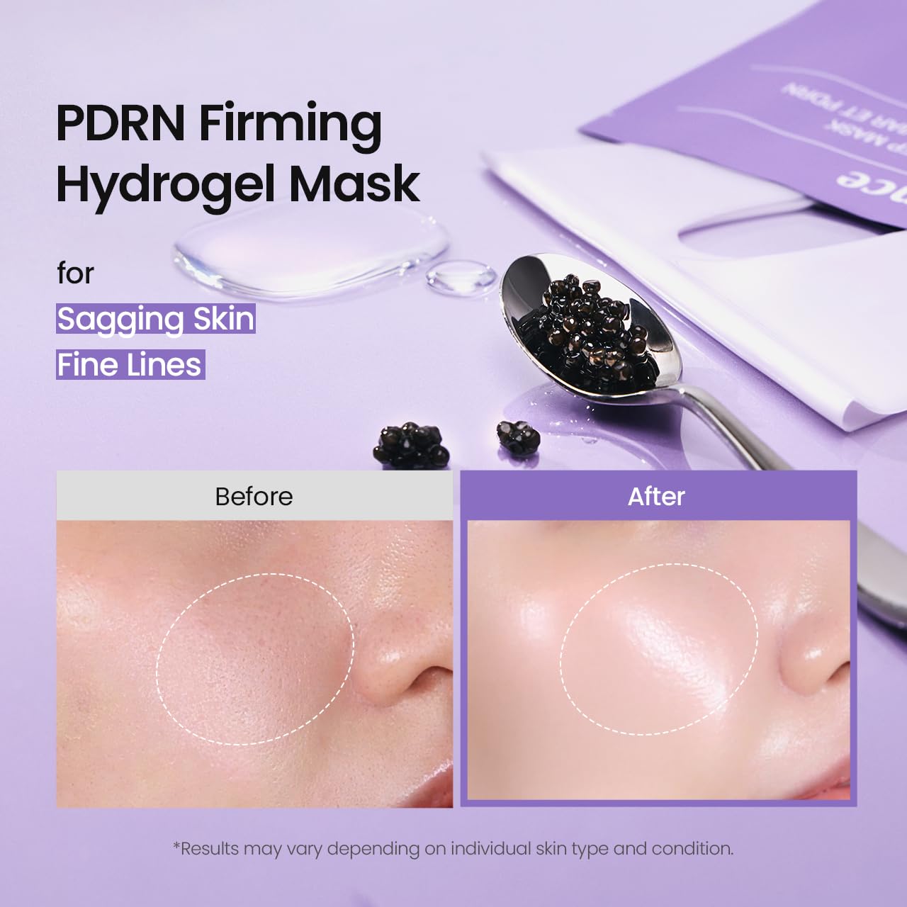 HotBIODANCE Rejuvenating Caviar PDRN Real Deep Mask, Overnight Hydrogel Face Mask, Skin Firming, Radiance, Enhancing Skin Recovery, Korean Skin Care, Self Care Gifts for Women | 1.19oz(34g) x 4ea