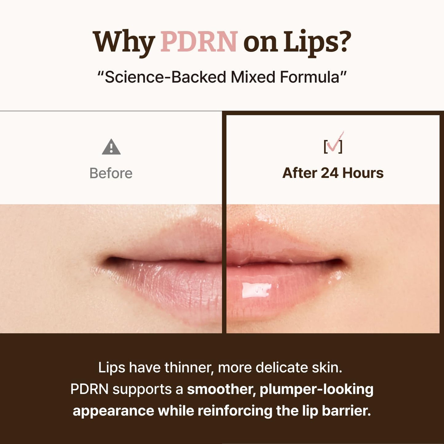 HotDr.Reju-All Advanced PDRN Rejuvenating Lip Serum – Hydrating Lip Balm with Lipozip PDRN for Glowy, Dewy Lips – Gentle Exfoliating & Smoothing Lip Moisturizer – Hibiscus & Lactic Acid – 0.3 Fl Oz