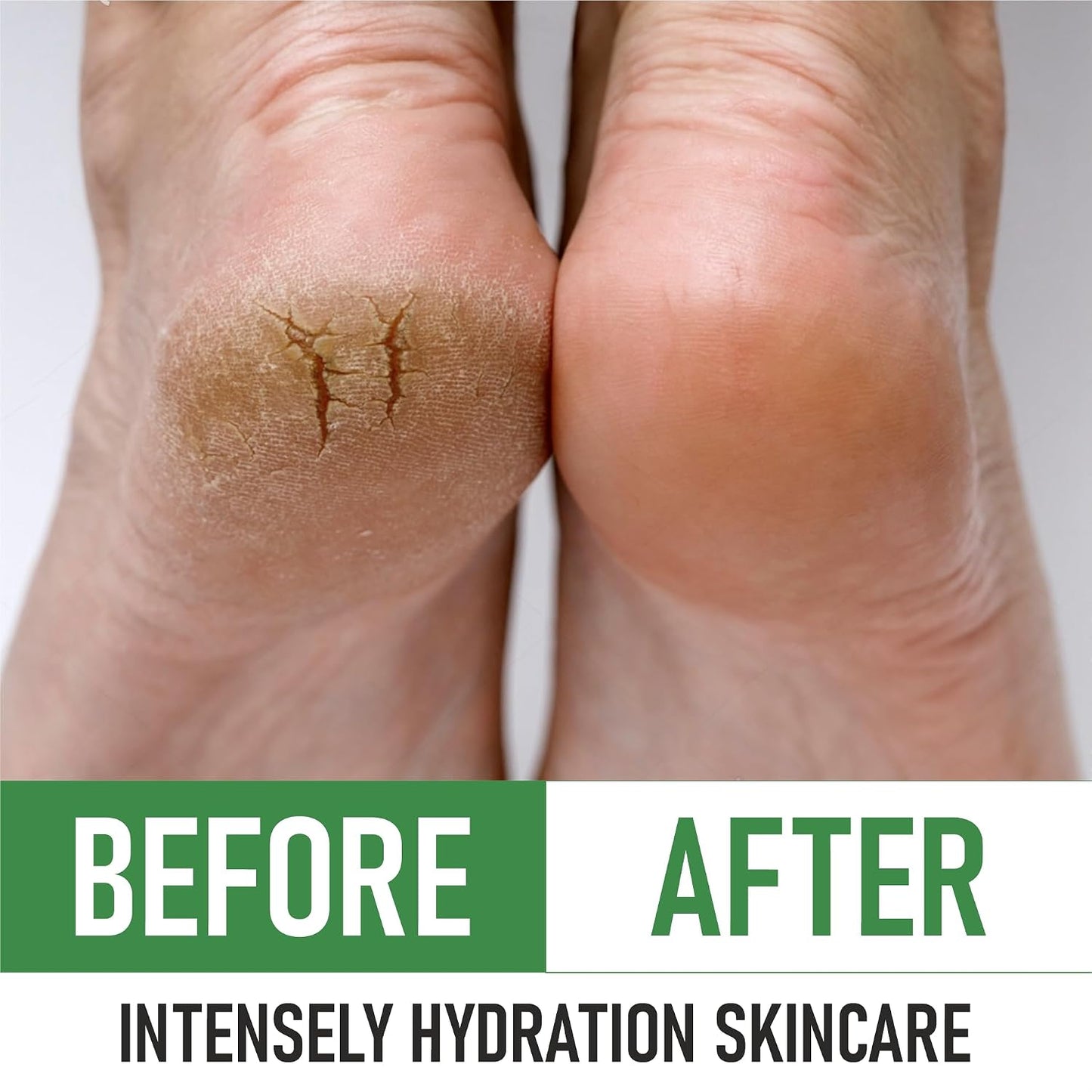 HotPurOrganica Urea Cream 40% – Made in USA, Maximum Strength Foot Cream for Dry, Cracked Heels, Corns, Calluses & Rough Feet, Exfoliating Moisturizer