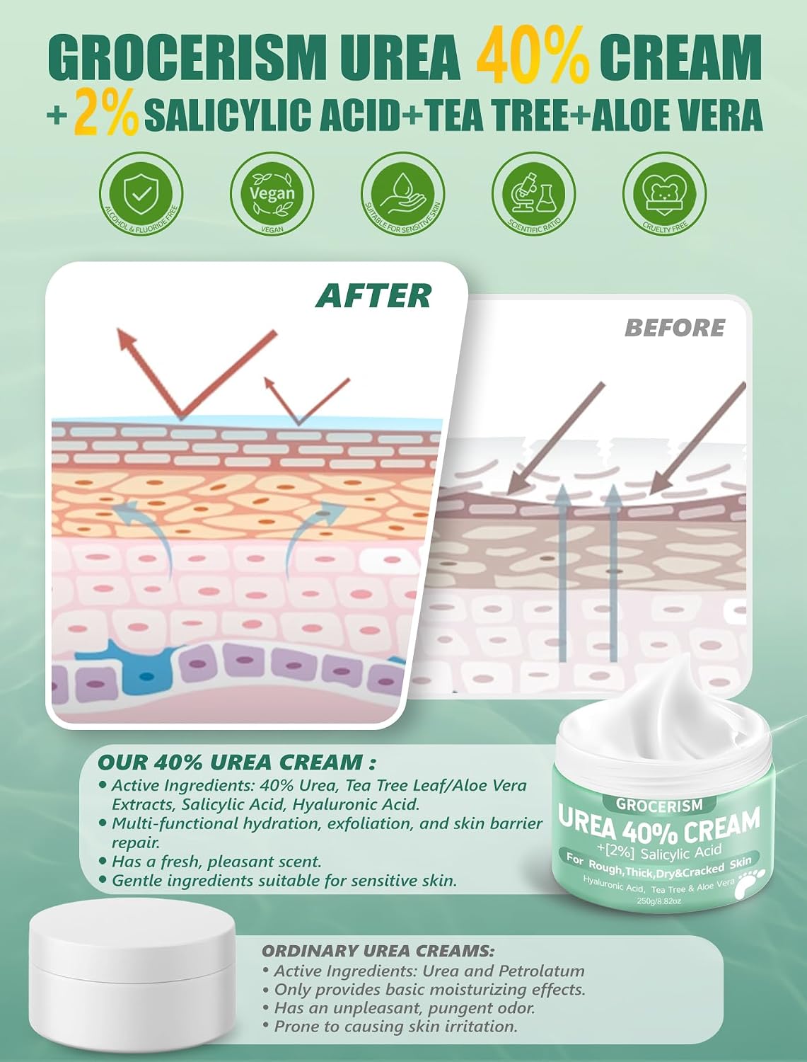 HotGrocerism Urea Cream 40 Percent for Feet with 2% Salicylic Acid 5.29 oz || Foot Cream and Hand Cream Maximum Strength for Dry, Rough, Callused Skin, Exfoliating Moisturizer for Heels, Elbows and Knees