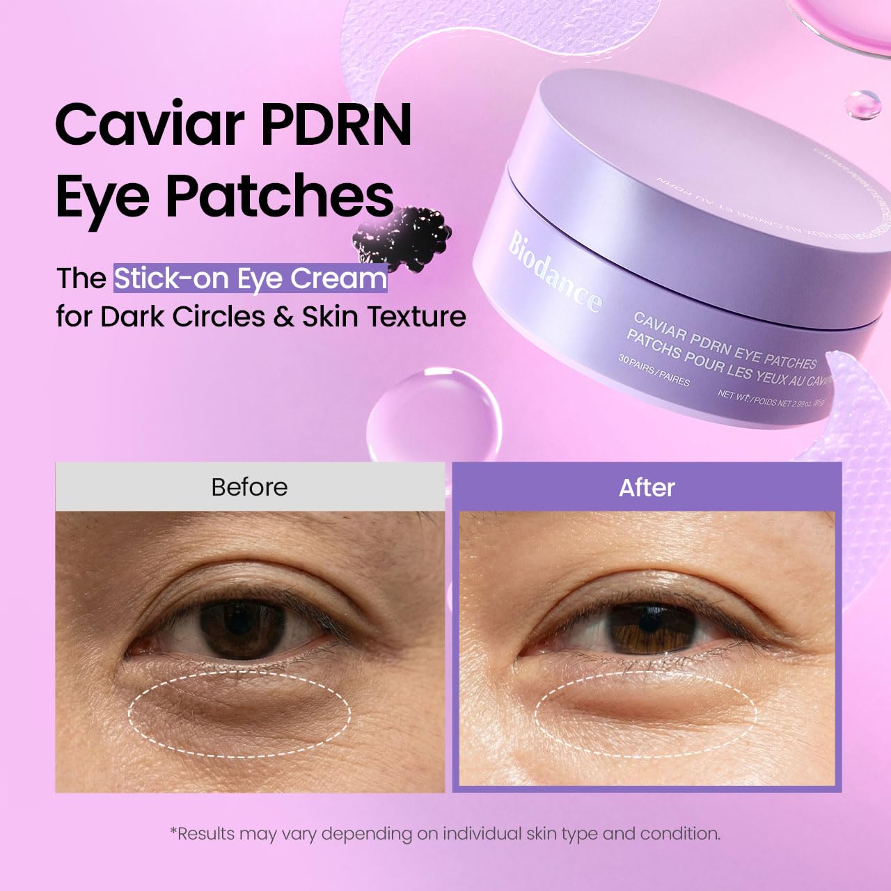 HotBIODANCE Caviar PDRN Eye Patches, Nourishing Under Eye Patches for Dark Circles, Depuffing Eye Mask for Puffy & Tired Eyes, Travel Essentials & Self Care Gifts for Women, Korean Skin Care (60 Count)