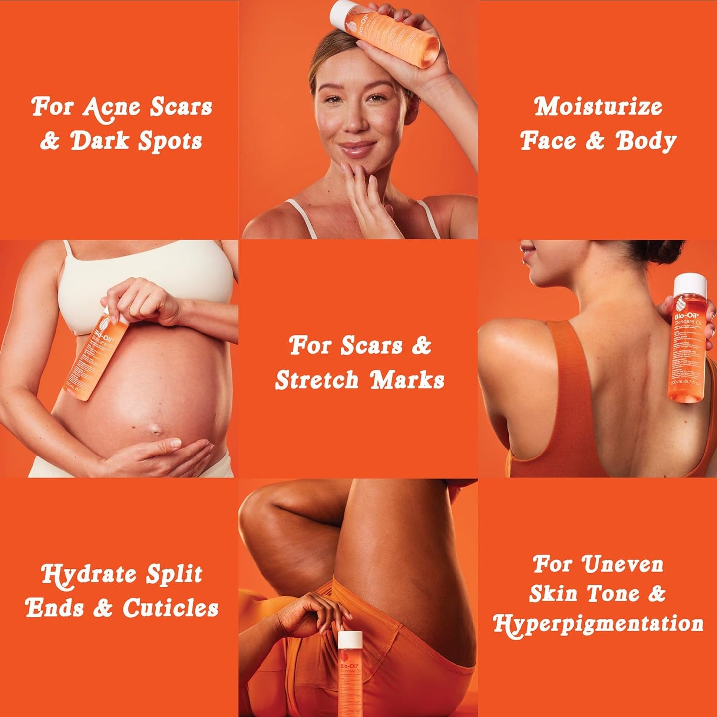 HotBio-Oil Skincare Body Oil Serum, Scars & Stretch Marks, 6.7 fl oz | Dermatologist Recommended, Vitamin E & A, Dry & Sensitive Skin, Non-Comedogenic, Face and Body, Scar Treatment