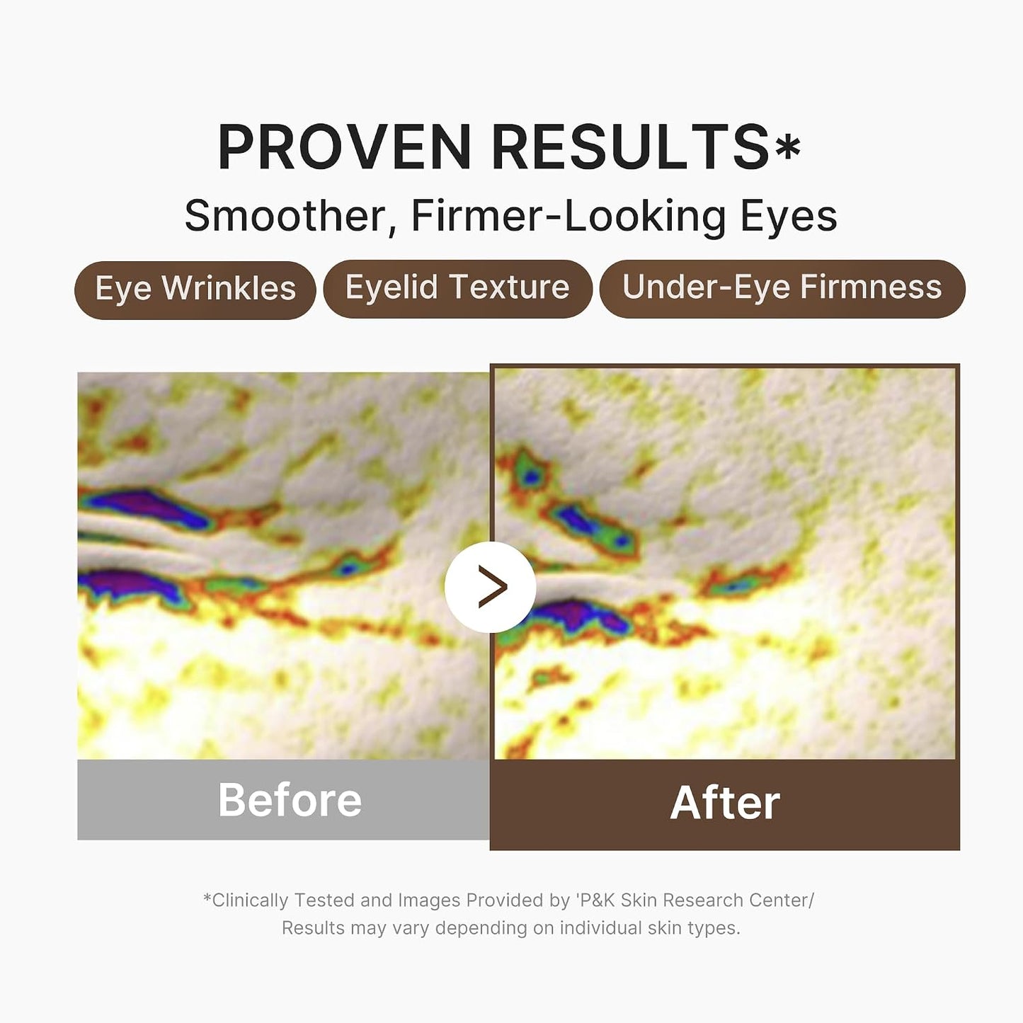 Hotmedicube Eye Serum with Deep Reviving Peptide | Eye Treatment Serum with Multi Peptides, Niacinamide & Squalane | Reduces Signs of Aging and FIne Lines | Korean Skincare, 1.01 fl.oz