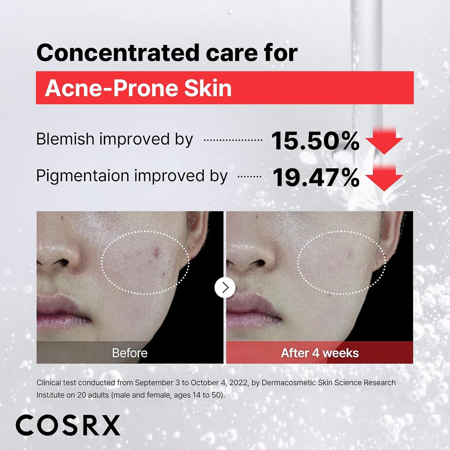 HotCOSRX 15% Niacinamide Face Serum, 0.67 fl oz, Pore Minimizer Serum for Face, Even Skin Tone, Korean Skin Care
