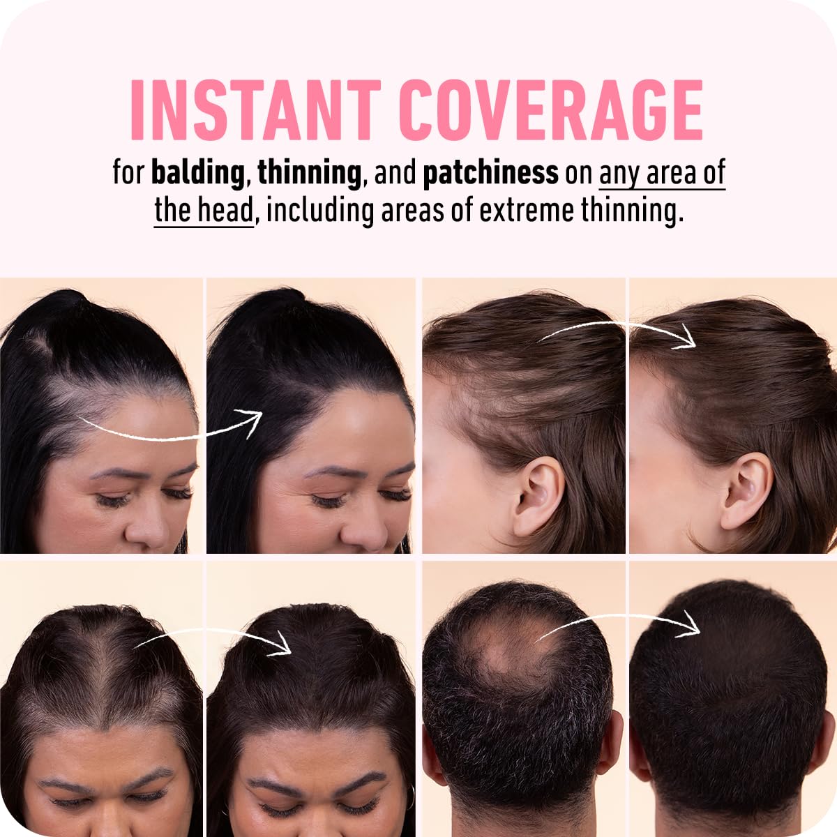 HotBOLDIFY Hairline Powder - Water-Resistant Root Touch Up Hair Color for Gray Coverage - 24-Hour Stain-Proof, Mess-Free Hair Powder for Thinning Hair (4g, Dark Brown)