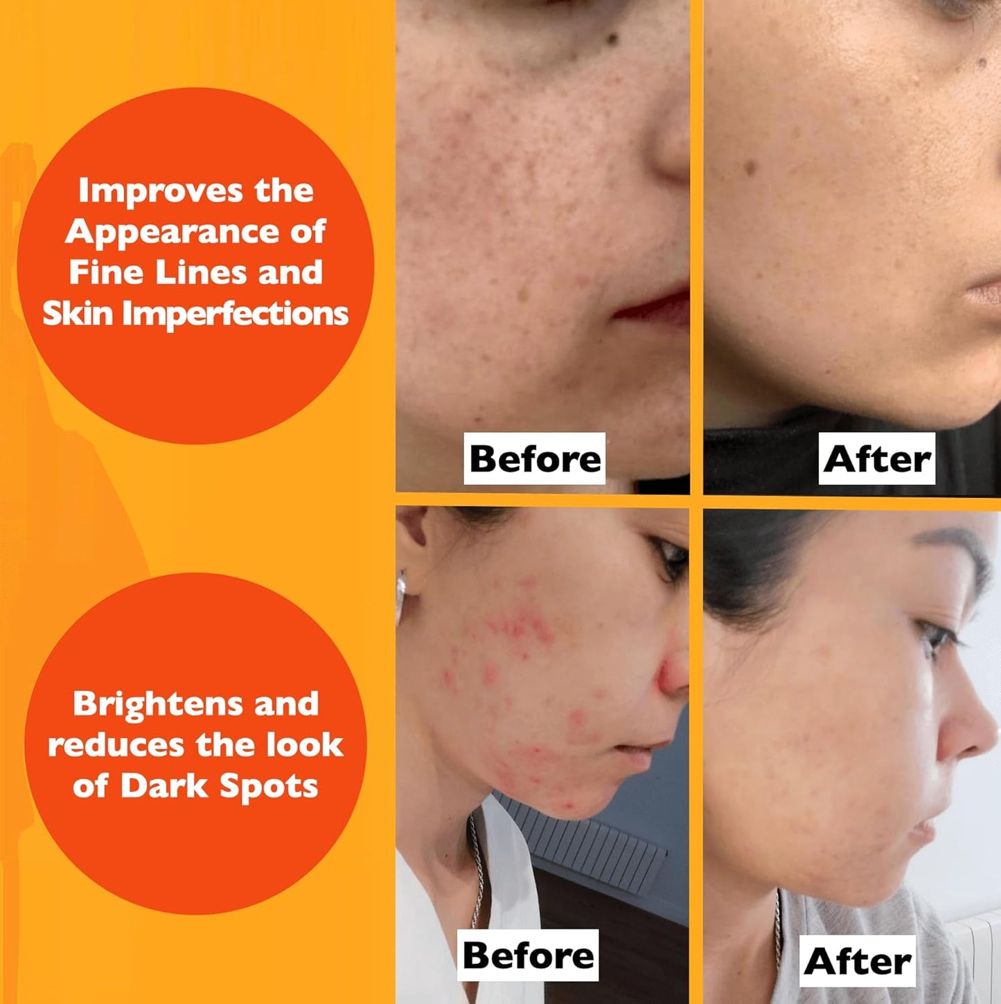 HotVitamin C Serum For Face – Anti Aging Face Serum with Vitamin C, Hyaluronic Acid, Vitamin E. Brightening Formula. Improve Appearance of Dark Spots, Tone, Fine Lines & Wrinkles, Glowing Skin 2 Fl Oz