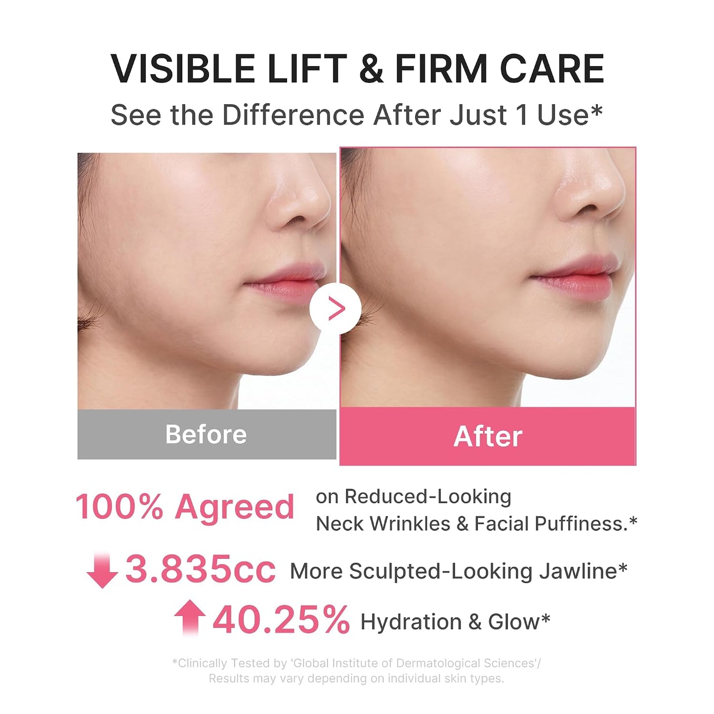 Hotmedicube PDRN Collagen Gua Sha Neck Wrinkle Cream | Built-In Gua Sha Massager with Volufiline 5% | Firming, Contour Care for the Look of Fine Lines, Jawline, Neck, Décolleté | Korean Skincare, 3.17 oz