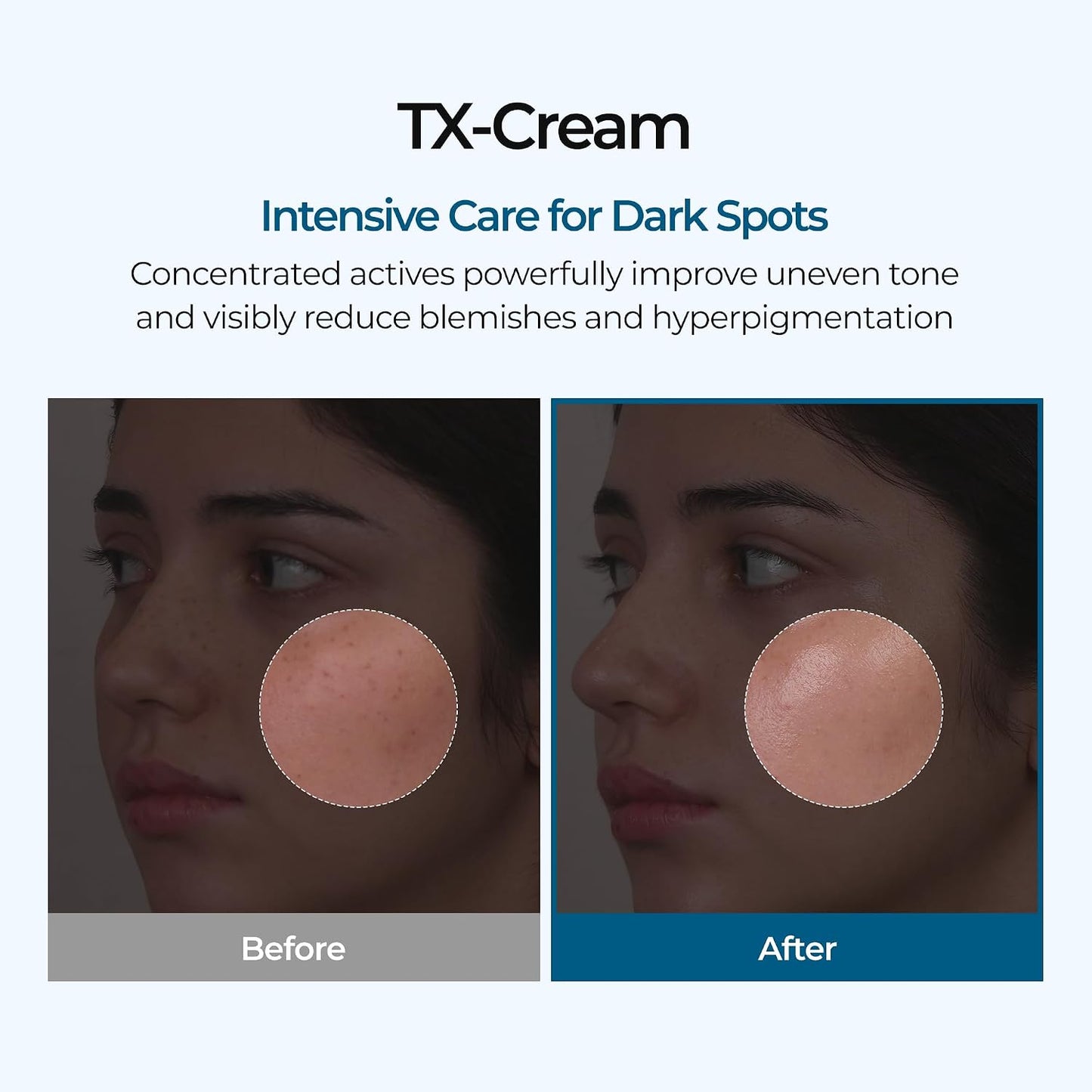 HotDR.Melaxin TX Tranexamic Acid CREAM | Skin freckle Cream, Blemishes, Anti-pigmetation korean skin care | Korean Cosmetics | 1.7 fl oz (50 ml)