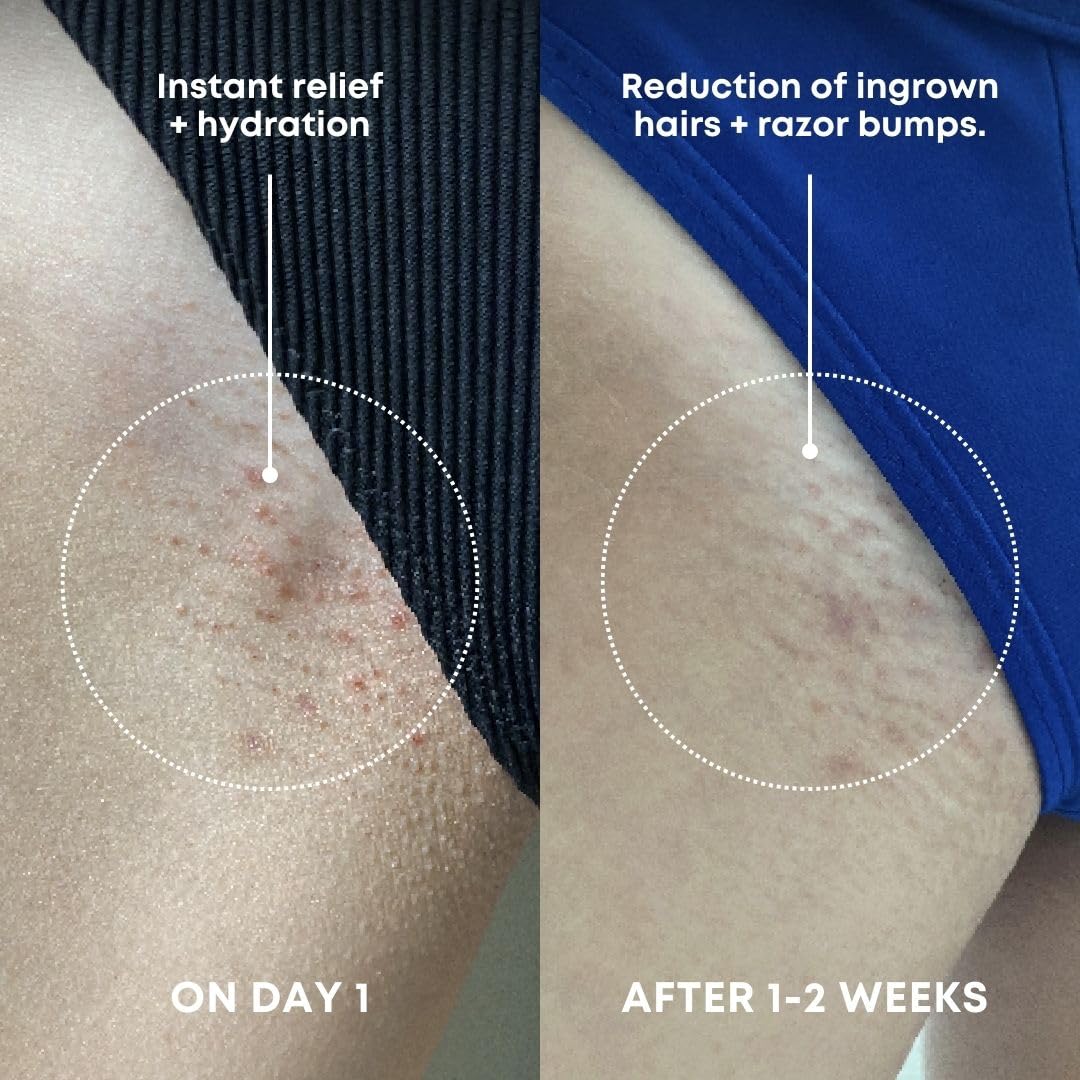 HotBushbalm Ingrown Hair Exfoliating Scrub - Reduces Appearance of Ingrown Hairs and Razor Bumps, Soothes Skin and Post-Shave Redness - Nude, 236 ml