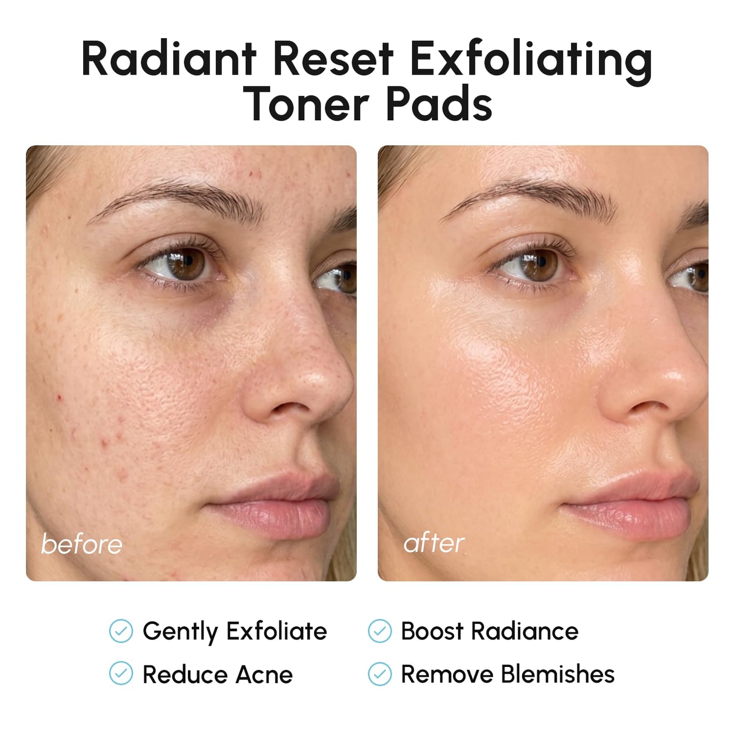 HotMAREE Glycolic Acid Pads - Toner Pads for Face Cleansing - Exfoliating Pad with Tea Tree Oil, Salicylic Acid & Vitamins E, B3, B5 - Facial Polishes & Peels, Skin Pore Resurfacing & Radiance - 50 Count