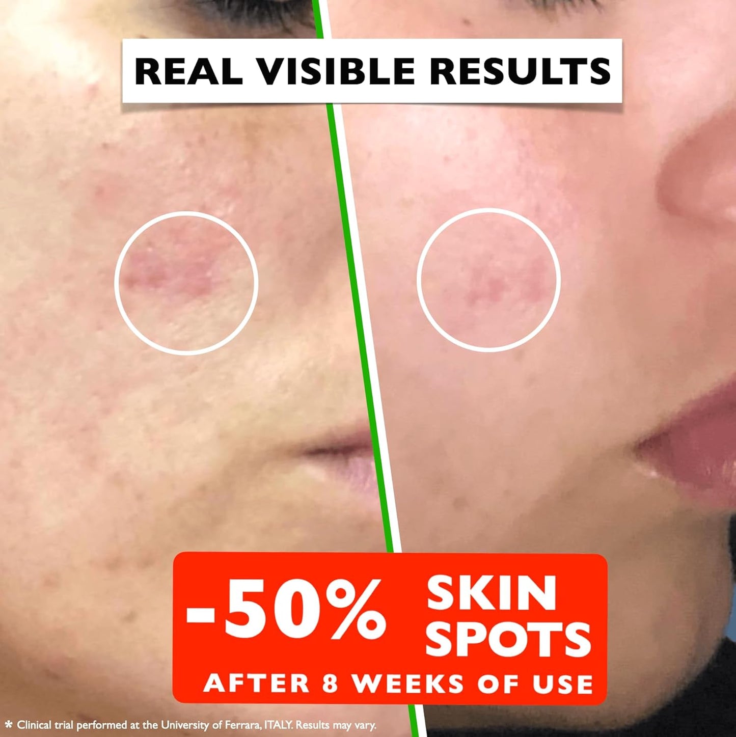 HotVitamin C Serum For Face – Anti Aging Face Serum with Vitamin C, Hyaluronic Acid, Vitamin E. Brightening Formula. Improve Appearance of Dark Spots, Tone, Fine Lines & Wrinkles, Glowing Skin 2 Fl Oz
