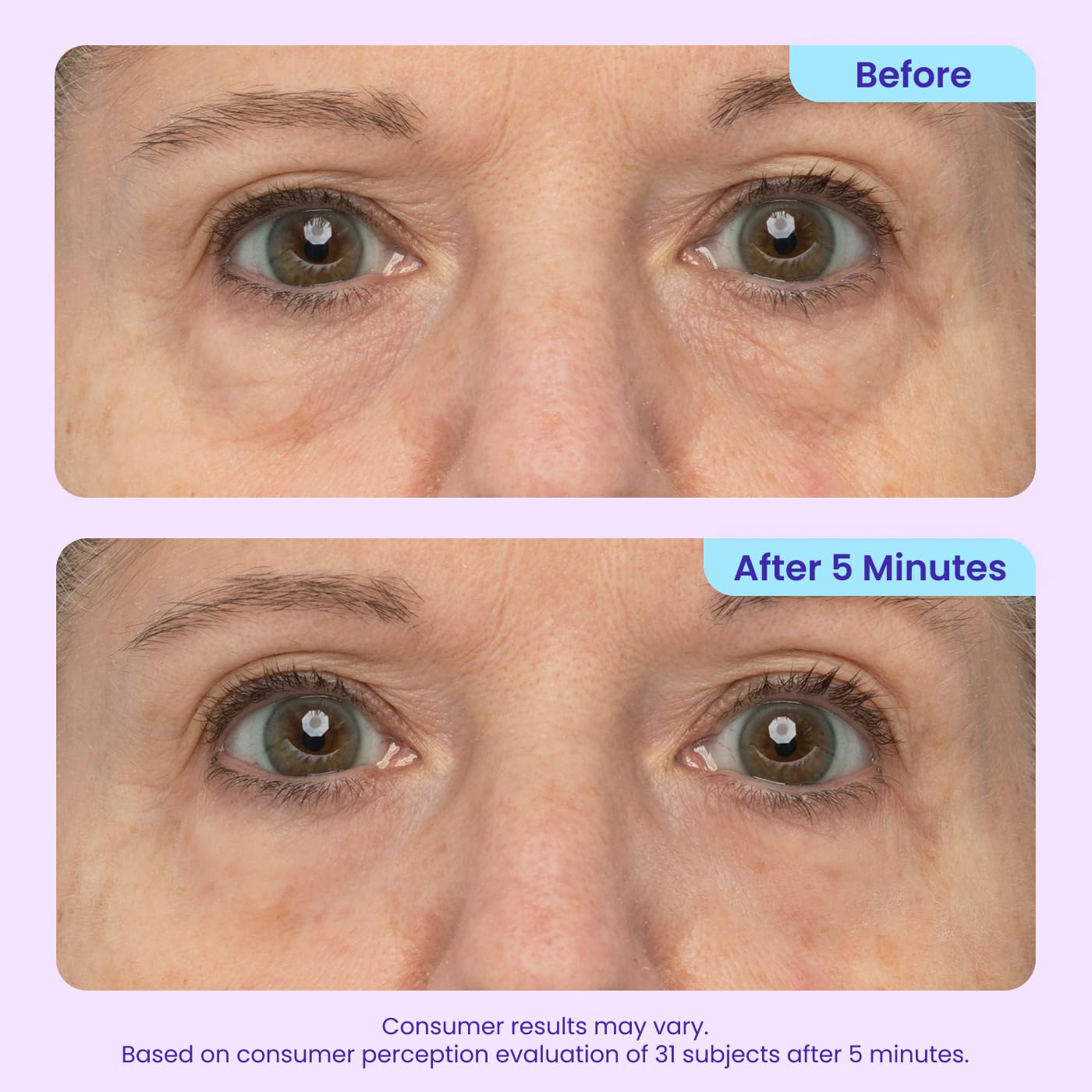 HotgoPure NEW Instant Lift Eye Gel - For the look of Puffiness & Bags, Wrinkles, Fine Lines and Dark Circles, Anti Aging Skin Care for Men & Women with MaxLift3 Biotech Under Eye Brightener