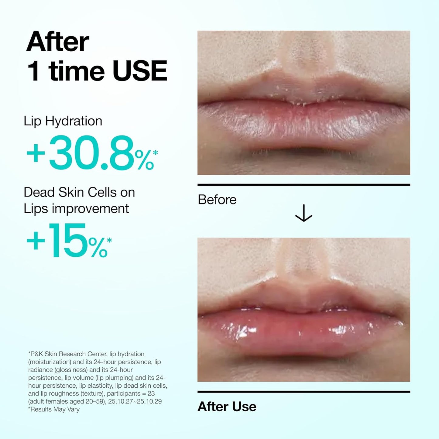 HotAnua PDRN Lip Serum, Long-lasting Hydration for Dry, Cracked Lips, Non-Sticky Moisturizing Lip Care with Salmon DNA, Hyaluronic Acid & Collagen, Korean Skincare, 0.33 fl.oz
