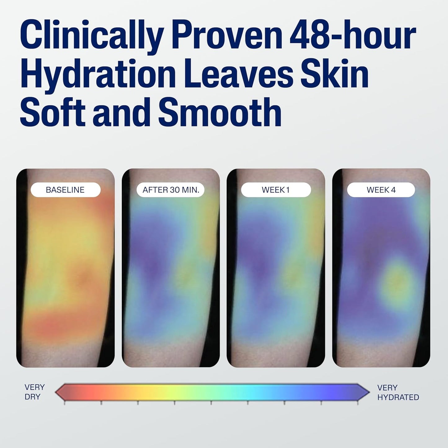 HotCetaphil Face & Body Moisturizer, Hydrating Moisturizing Lotion for All Skin Types, Suitable for Sensitive Skin, NEW 20 oz, Fragrance Free, Hypoallergenic, Non-Comedogenic