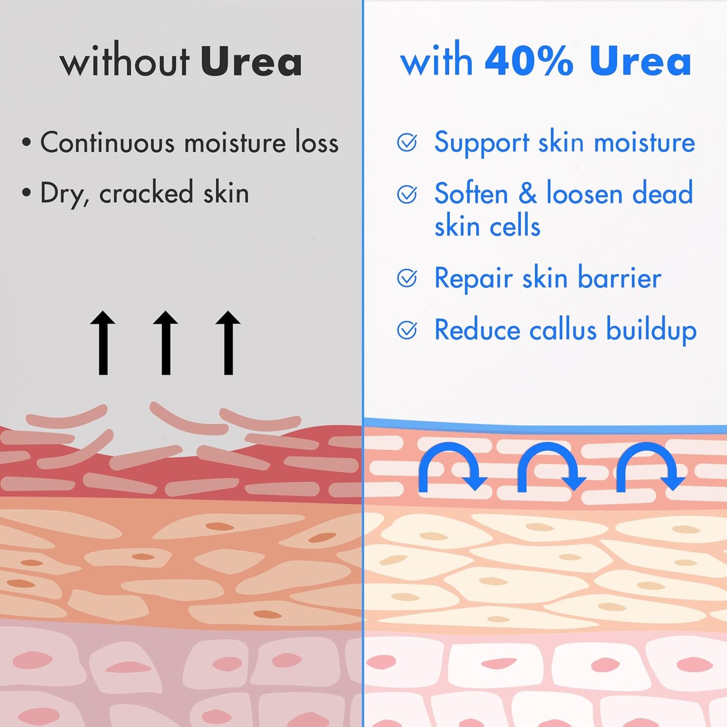 HotEbanel Urea Cream 40% plus Salicylic Acid 2% for Dry Cracked Feet Skin | Deeply Moisturizes & Softens Dry Cracked Heels, Feet, Knees, Elbows, Hands, Rough Dead Skin Callus Remover Toenail Softener