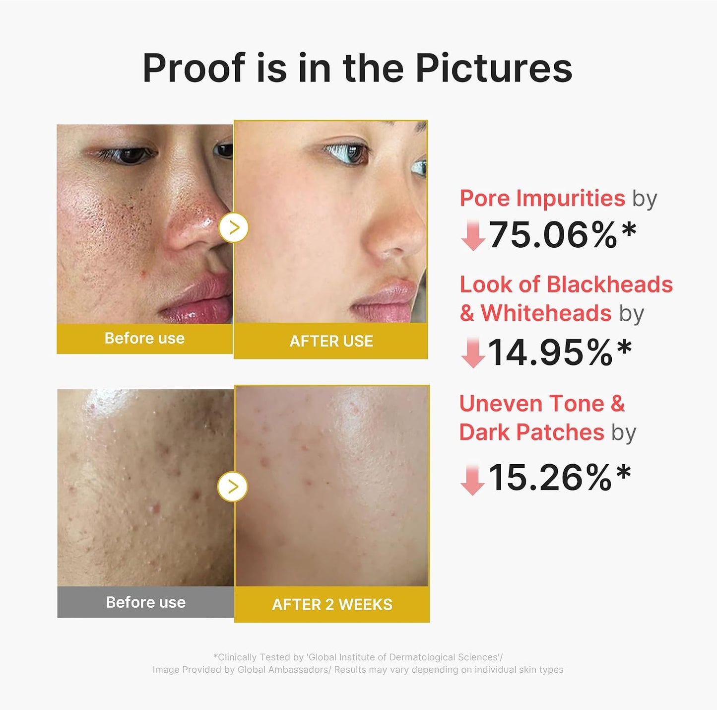 Hotmedicube Peel Shot with Kojic Acid Turmeric | Reset in One Step | Gentle Exfoliating Serum with BHA, LHA, PHA for Dead Skin Cells, Blackheads, Excess Sebum | For Dull, Rough, Troubled Skin | 2.7 fl.oz