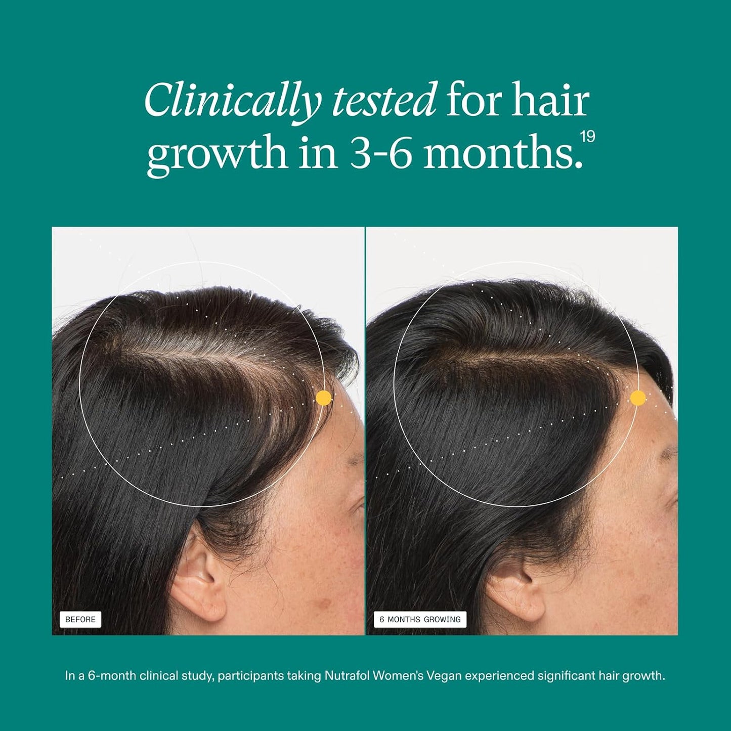 HotNutrafol Women's Hair Growth Supplements, for Women 18-44 Years Old, Clinically Tested for Visibly Thicker, Stronger Hair, 100% Vegan Ingredients, Dermatologist Recommended - 1 Month Supply
