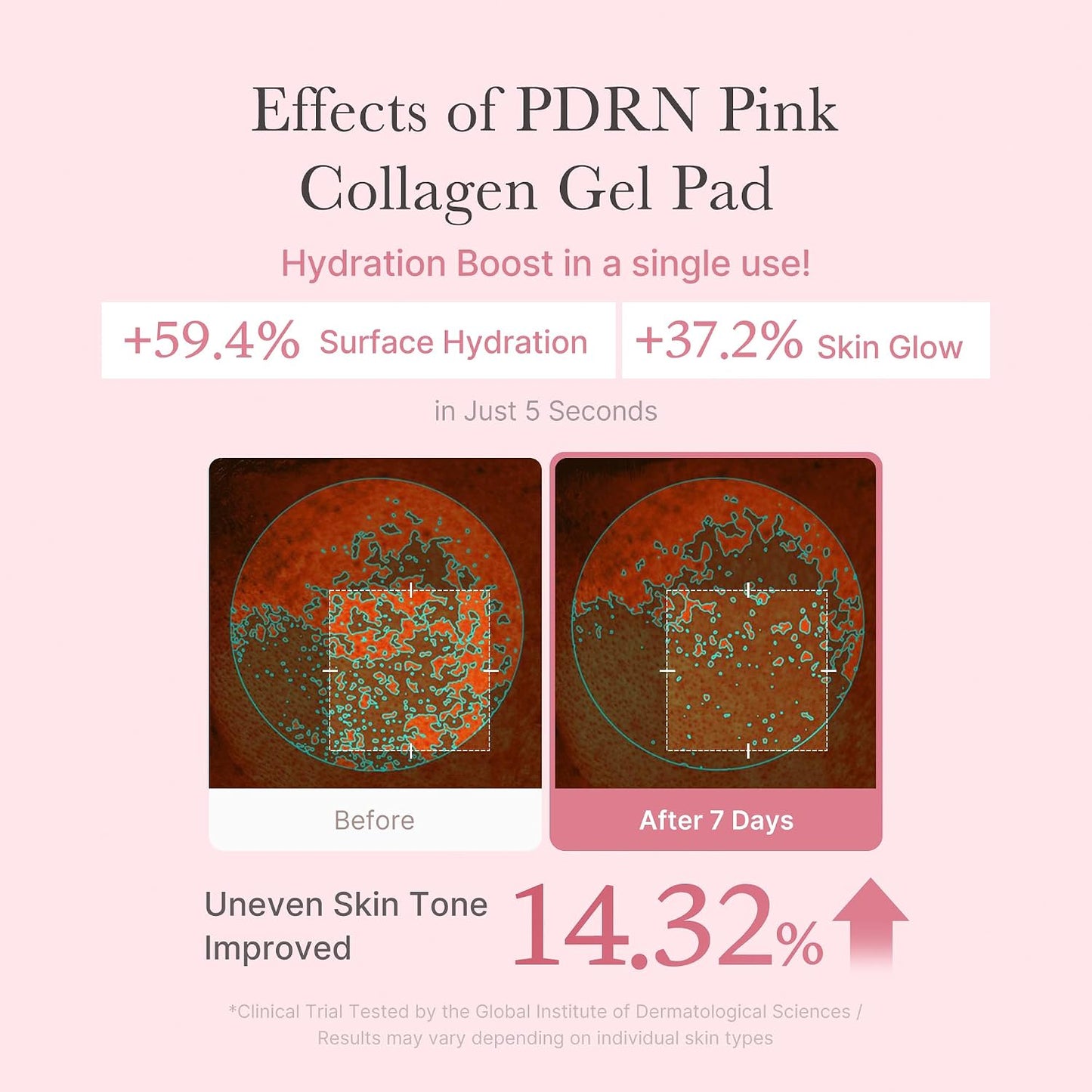 Hotmedicube Toner Pads Salmon DNA PDRN Pink Collagen Jelly Pad | Korean Gel Toner Pad | Niacinamide, Madecassoside, Retinol | Soothing, Radiance, Uneven Skin Tone | Korean Skin Care | 70 Pads (1 Pack)