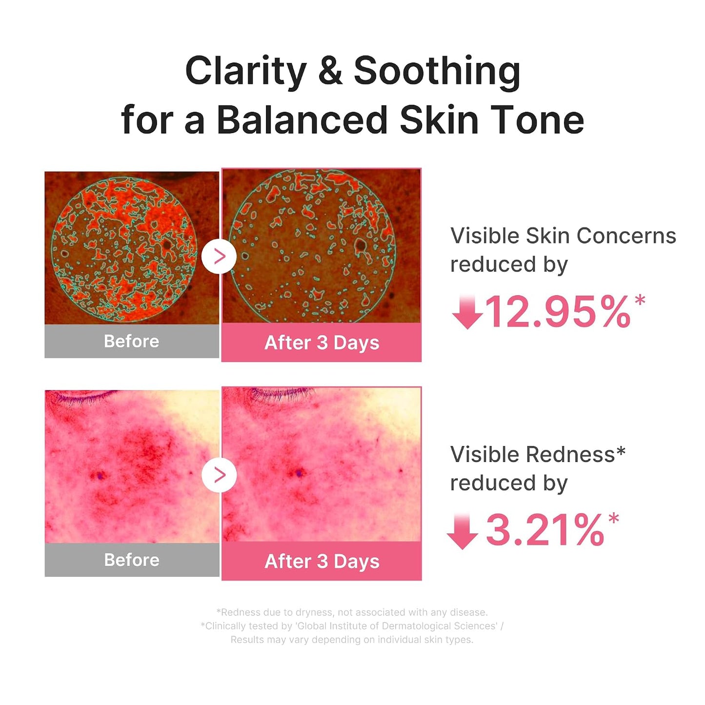 Hotmedicube PDRN Pink Peptide Serum with Salmon DNA | Ultra Light Hydrating Serum with Hyaluronic Acid | Fast-Absorbing Glow Care for Skin Clarity | Korean Skincare, 3.71 fl. Oz