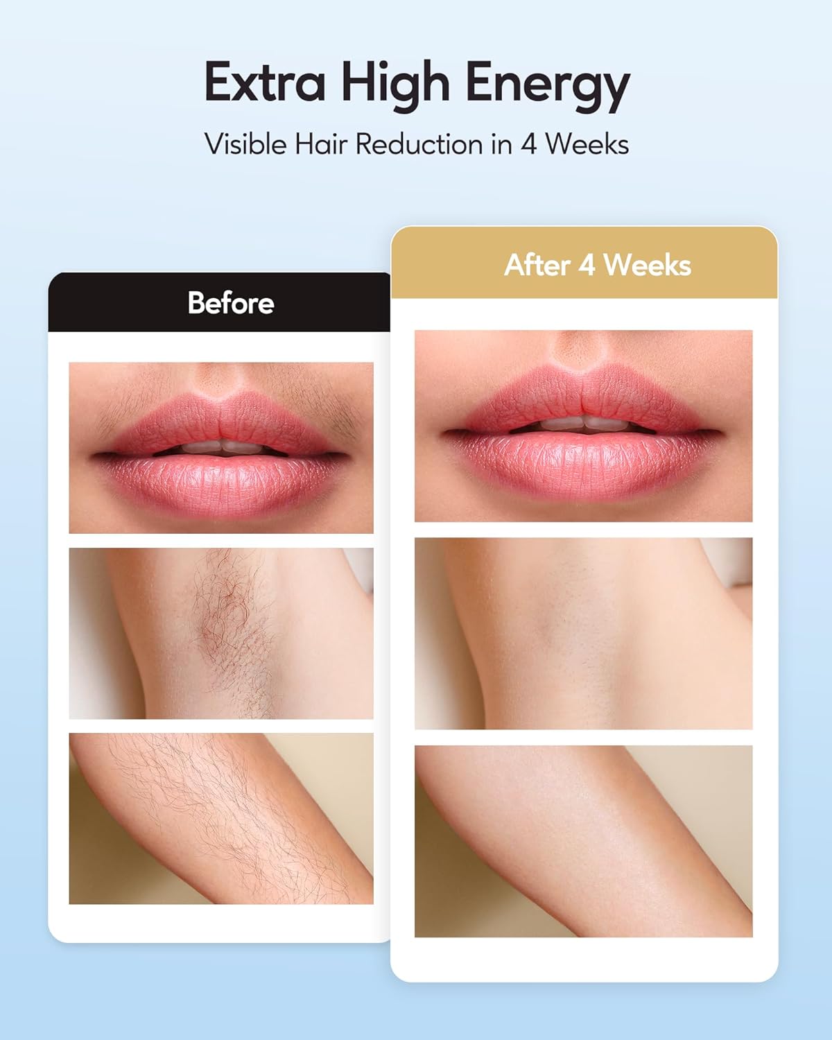 HotINNZA IPL Hair Removal with Ice Cooling Care Function for Women,Long-Lasting Results,999,999 Flashes Painless Hair Removal, Hair Removal Device for Armpits Legs Arms Bikini Line,Corded