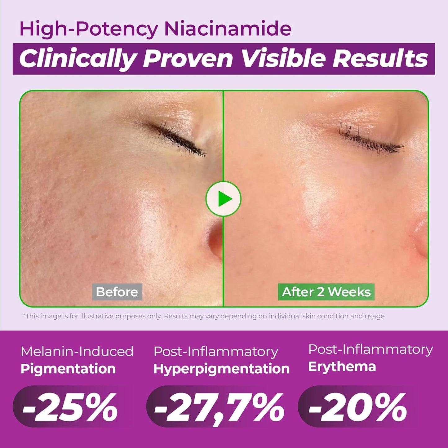 HotJUMISO 20% Niacinamide Dark Spot Correcting Serum for Face, 1.35 fl oz | TXA, Glutathione, Hexylresorcinol & Centella – Pore Care, Post-Blemish Marks, Glass Skin, Fragrance-Free