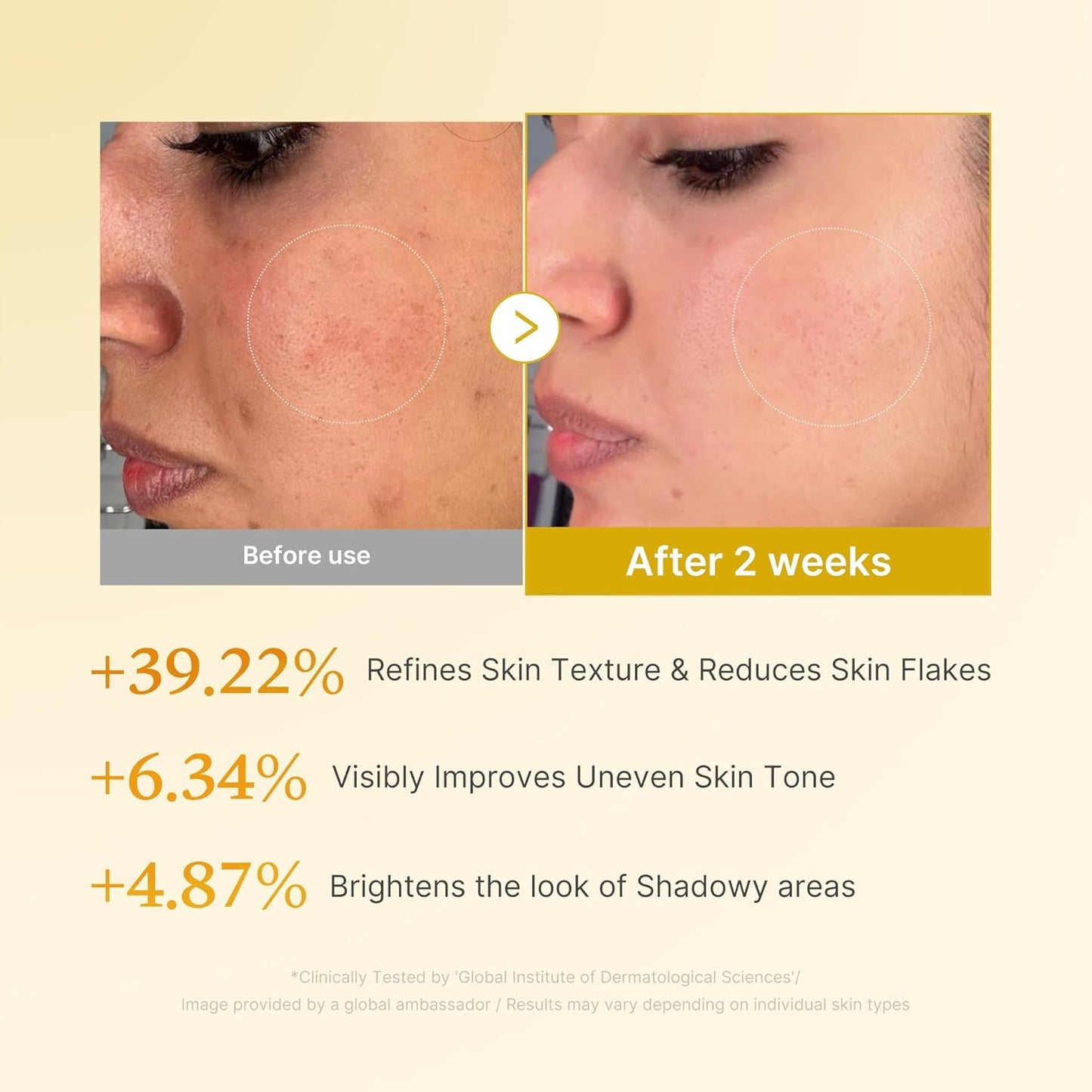 Hotmedicube Kojic Acid Turmeric Smoothing Toner for Face & Body | Lightweight Toner for Balancing Uneven Skin Tone & Texture | Niacinamide, Glycolic Acid for Clear Glass Skin | 8.45 fl.oz