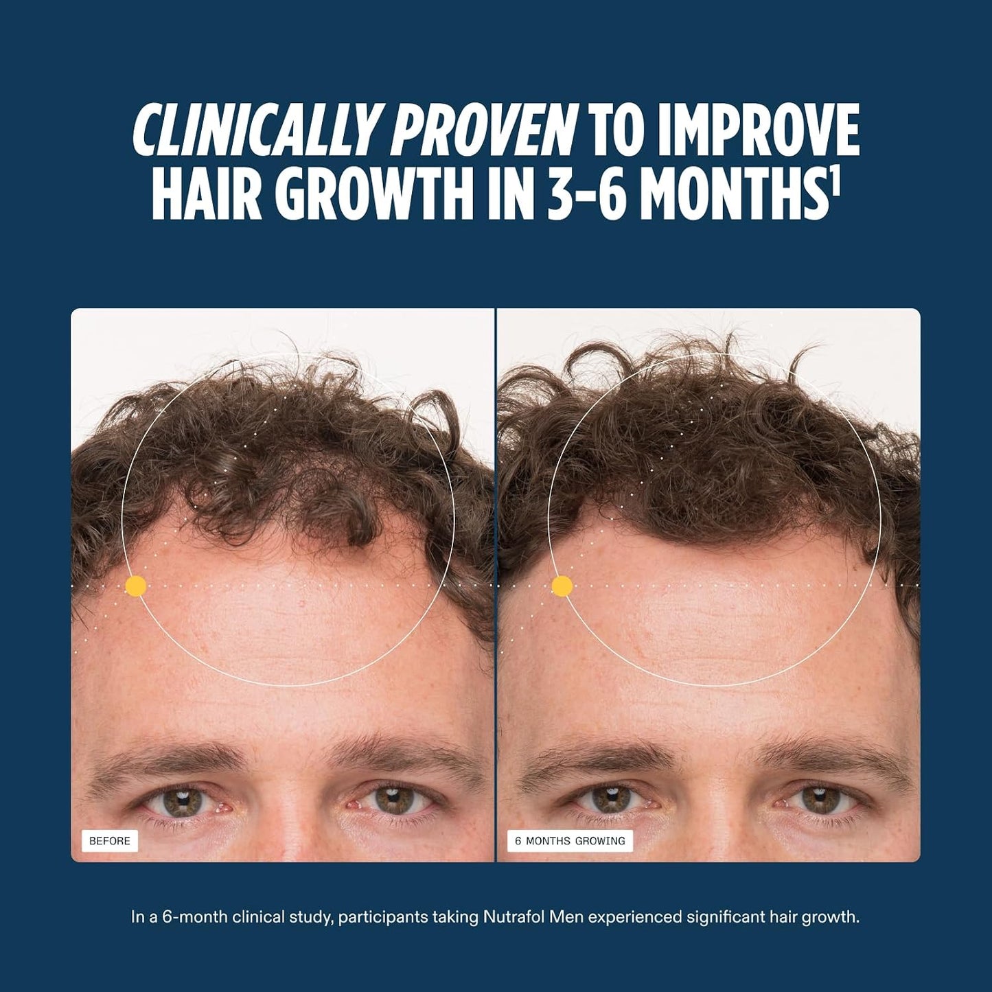 HotNutrafol Men's Hair Growth Supplements, Clinically Tested for Visibly Thicker Hair and Scalp Coverage, Dermatologist Recommended - 1 Month Supply