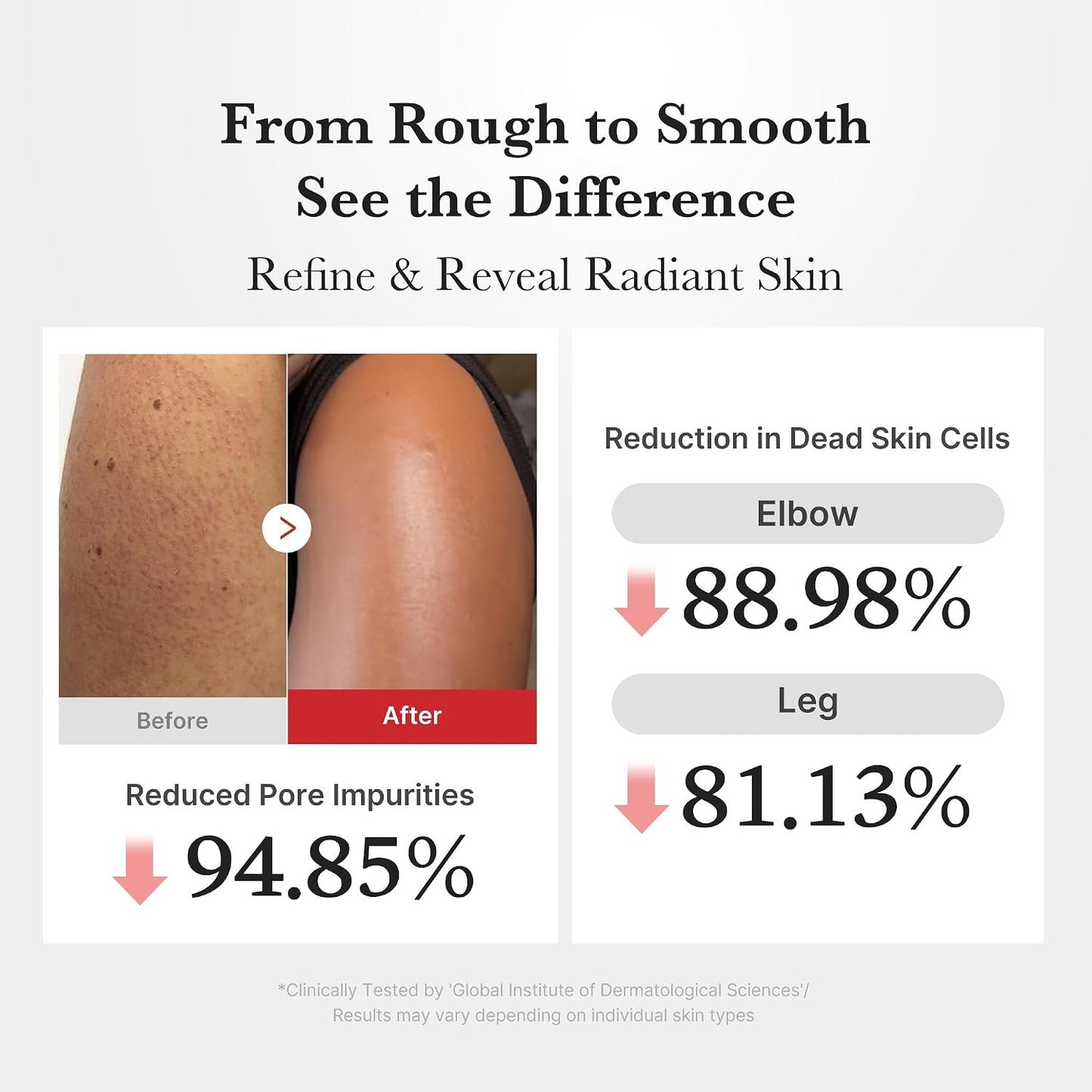 Hotmedicube Body Peel Shot with Hypochlorous Acid | Gentle Body Exfoliating for Dead Skin Cells & Uneven Texture - Rice Extract, Panthenol for Hydrating & Smoothing, 9.46 fl.oz
