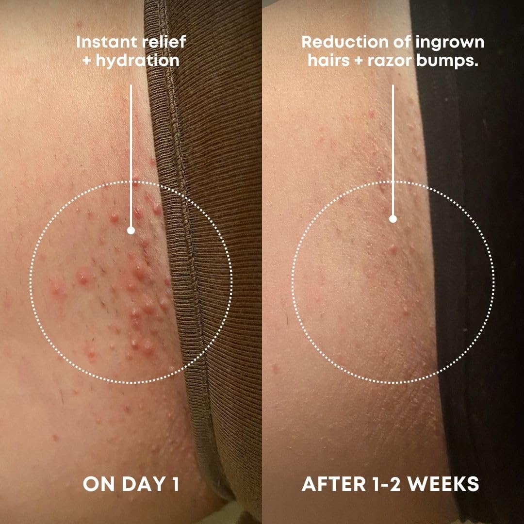 HotBushbalm Ingrown Hair Exfoliating Scrub - Reduces Appearance of Ingrown Hairs and Razor Bumps, Soothes Skin and Post-Shave Redness - Nude, 236 ml