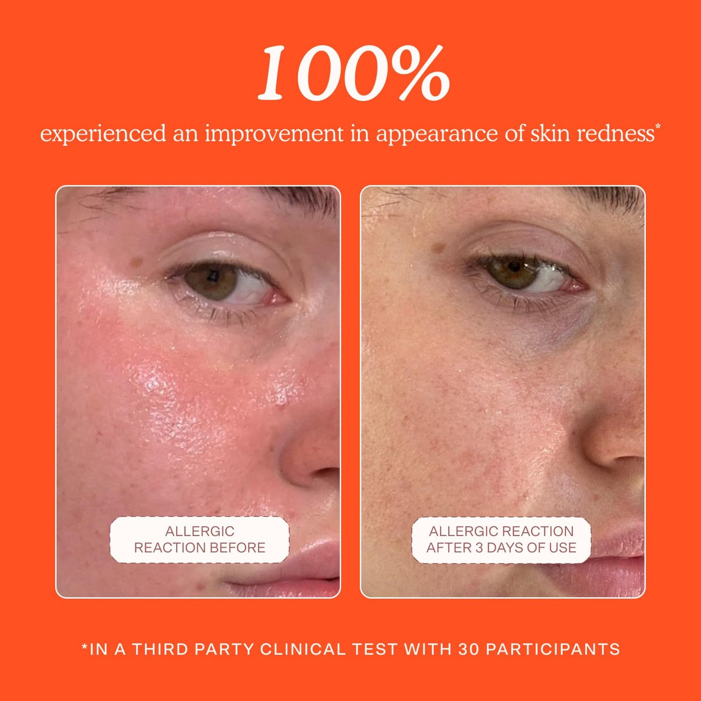 HotTower 28 SOS Daily Rescue Facial Spray - Hypochlorous Acid Spray to Help Visibly Calm + Soothe Sensitive Skin - Purifying Face Toner - Everyday Skin Care Essential (4 oz)