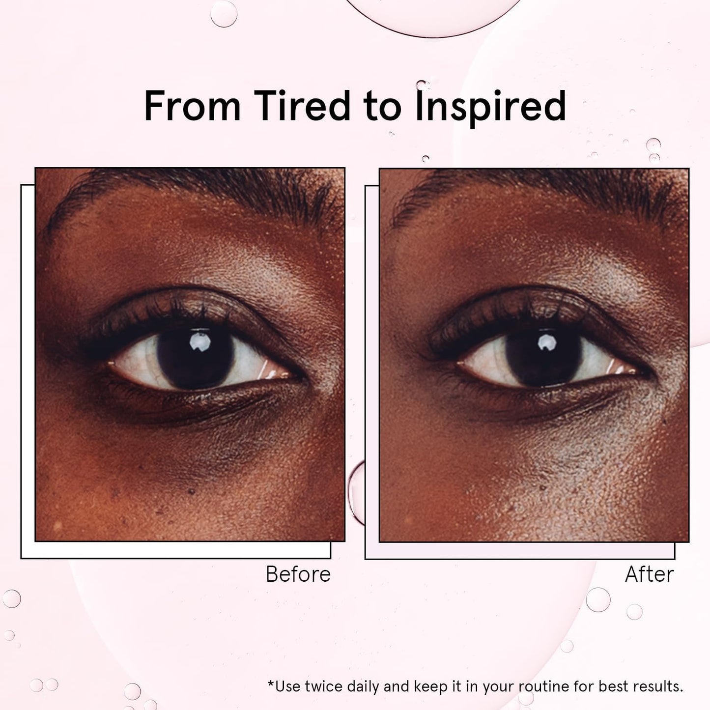 Hotgrace & stella Under Eye Brightener with Cooling Metal Rollerball - Centella Asiatica & Caffeine Eye Serum for Puffy Eyes - Travel Essentials - Under Eye Cream - Travel Essentials (15ml / 0.51floz)