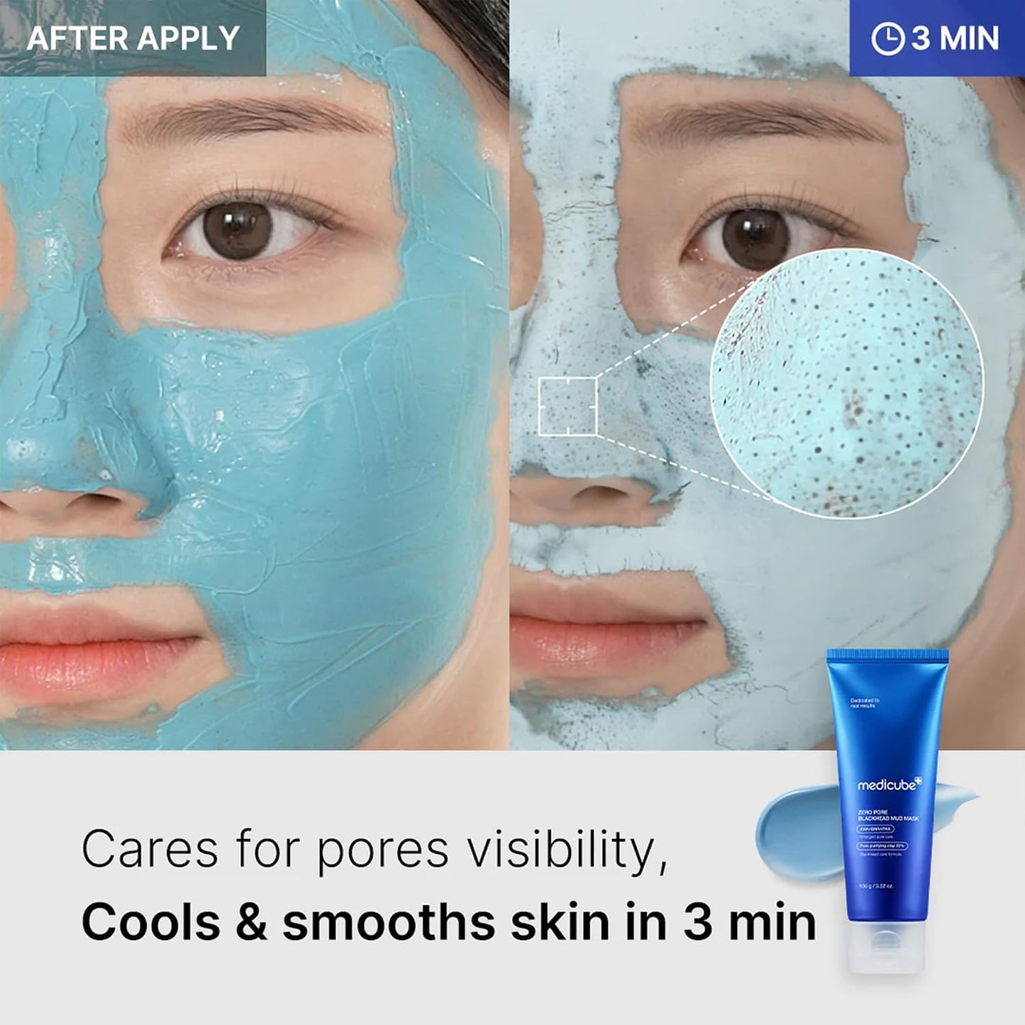 Hotmedicube Zero Pore Blackhead Mud Facial Mask - Skin Cooling & Pore Tightening - 3 Minute Quick Dry Formula with AHA, BHA, PHA, and Pore-Purifying Clay - Korean Mud Mask 3.52 oz