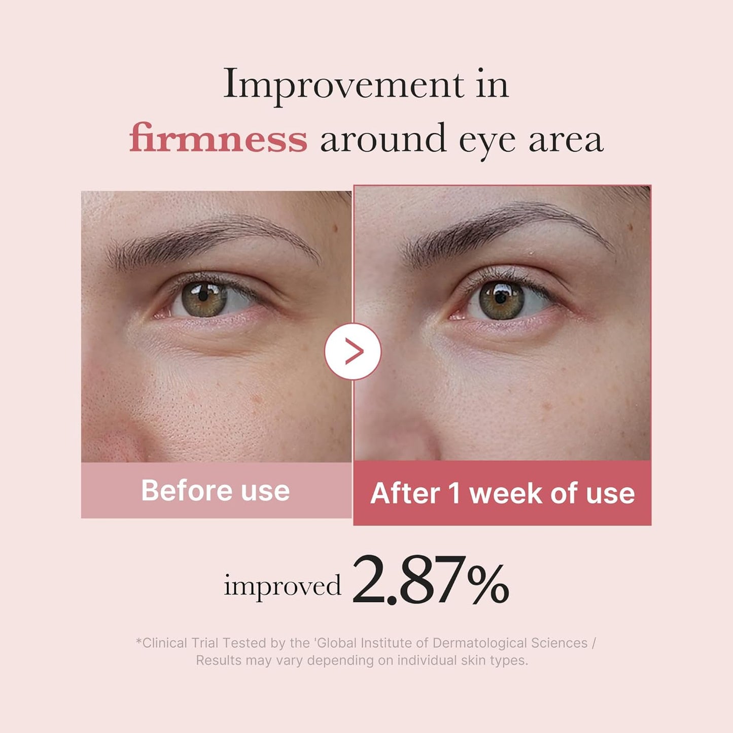 Hotmedicube Eye Serum with Salmon DNA PDRN & Pink Peptides | 99% Purity Retinol for Fine Lines | PDRN & Niacinamide for Uneven Skin Tone | Korean Skincare, 1.01 fl.oz