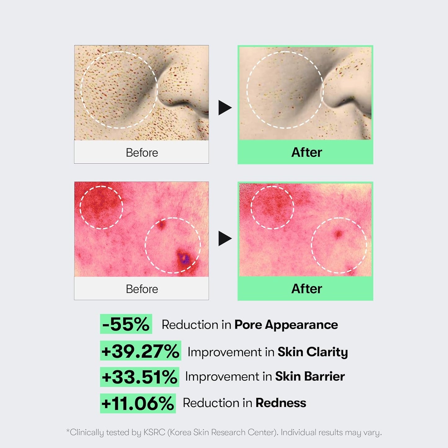 HotVT COSMETICS CICA Reedle Shot 100, Spicule Microneedling Serum for Pore Care & Exfoliation, Exosome, Centella Asiatica for Glass Skin, Skin Texture, Korean Liquid Skin Booster (1.69 Fl Oz / 50ml)
