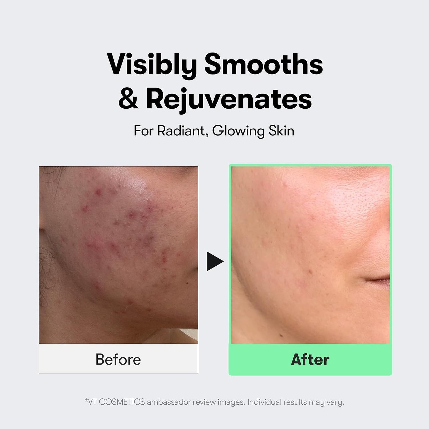 HotVT COSMETICS CICA Reedle Shot 300, Advanced Night Exosome, Microneedling Serum, Centella Asiatica, Hyaluronic Acid, Propolis, Soft Skin, Regeneration, Glass Skin, Korean Skin Booster 1.69Fl Oz (50ml)
