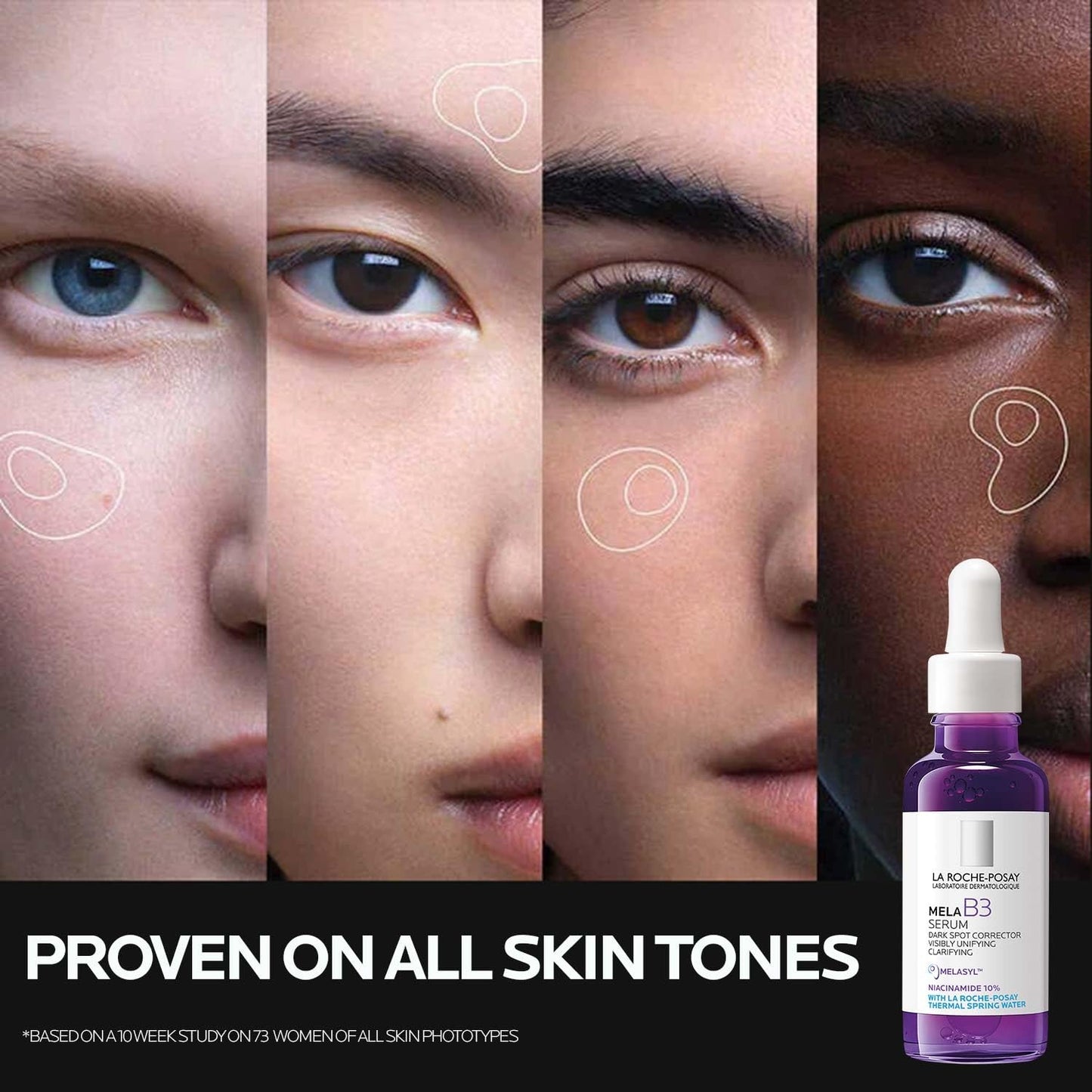 HotLa Roche-Posay Mela B3 Dark Spot Face Serum with 10% Niacinamide, 1oz | Anti-aging dark spot correcting face serum with Melasyl™ for sun spots, age spots, and post-acne marks. Lightweight texture.