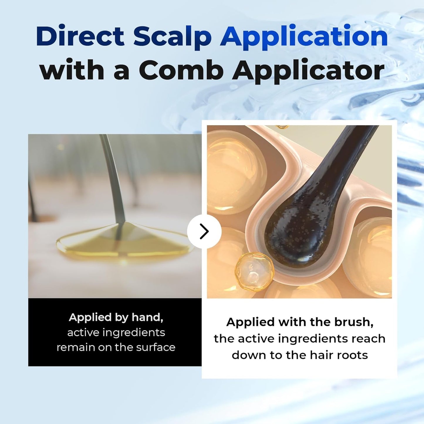 HotEPAIS Scalp Boosting Serum, Comb Applicator Scalp Ampoule with 38 Brush Tips, Clinically Tested Dandruff & Flake Reduction, Biome PDRN Exosome, Korean Hair Care, 5.07 fl.oz.