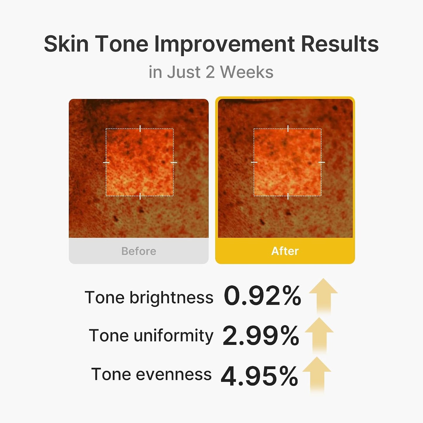 Hotmedicube Capsule Cream with Kojic Acid & Turmeric for Uneven Skin Tone | Tone Renewal & Radiance Care for troubled skin | Turmeric, Kojic, Vitamin C | Korean Skincare, 1.86 oz