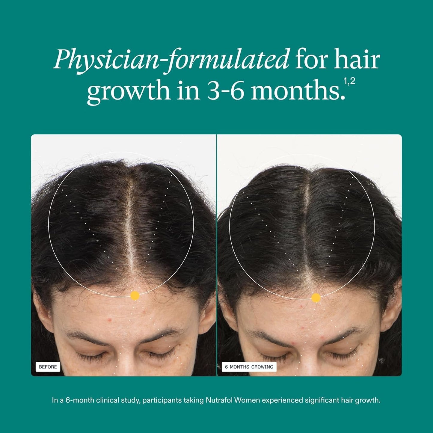 HotNutrafol Women's Hair Growth Supplements, Ages 18-44, Clinically Tested for Visibly Thicker and Stronger Hair, Dermatologist Recommended - 1 Month Supply