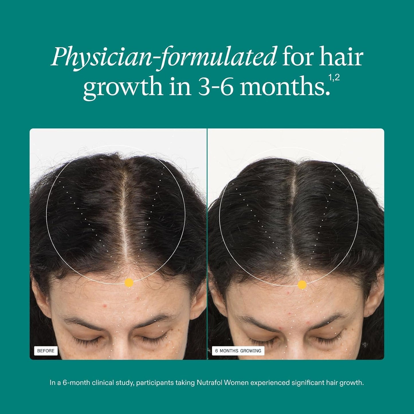 HotNutrafol Women's Hair Growth Supplements, Ages 18-44, Clinically Tested for Visibly Thicker and Stronger Hair, Dermatologist Recommended - 1 Month Supply