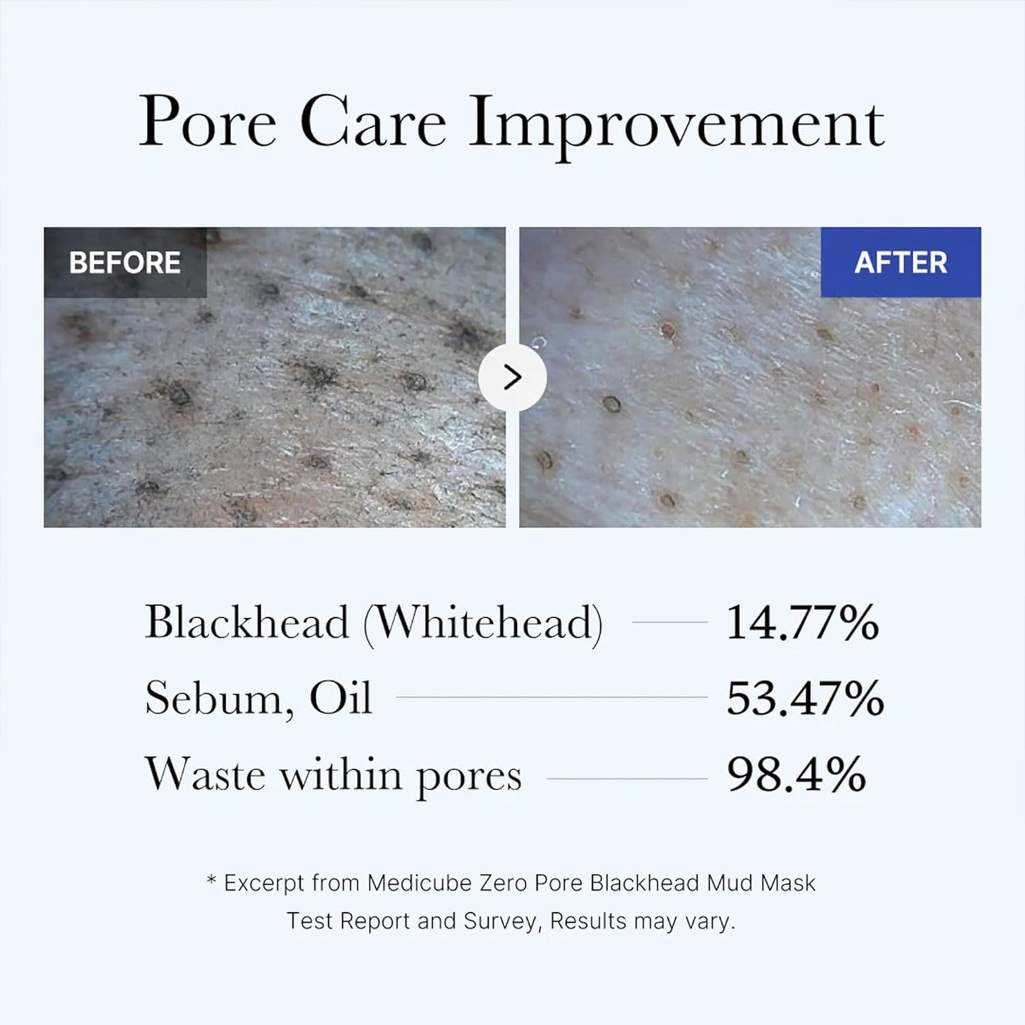 Hotmedicube Zero Pore Blackhead Mud Facial Mask - Skin Cooling & Pore Tightening - 3 Minute Quick Dry Formula with AHA, BHA, PHA, and Pore-Purifying Clay - Korean Mud Mask 3.52 oz