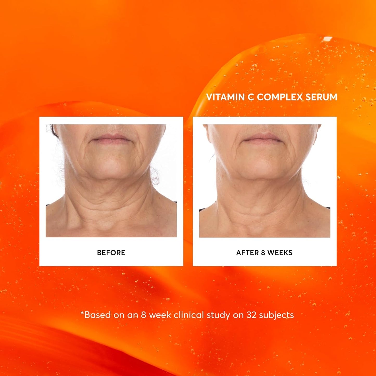 HotNaturium Vitamin C Complex Face Serum, Plus Hyaluronic Acid & Vitamin E, Anti Aging Skin Care Treatment, 1 oz