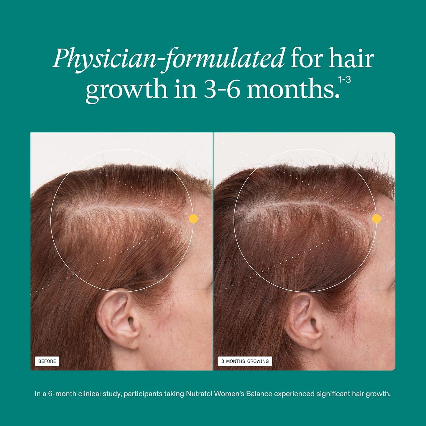 HotWomen's Balance Hair Growth Supplements, Ages 45 and Up, Clinically Tested for Visibly Thicker Hair and Scalp Coverage, Dermatologist Recommended - 1 Month Supply