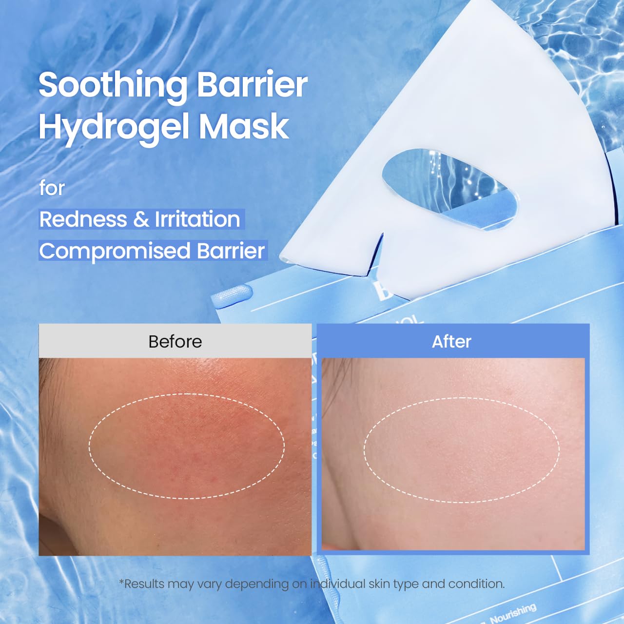 HotBIODANCE Hydro Cera-nol Real Deep Mask, Hydrating Overnight Hydrogel Face Mask, Moisturizing, Redness Reducing, Quick Soothing, After Sun Care, Sunburn Relief, Korean Skin Care |1.19oz(34g) x4ea